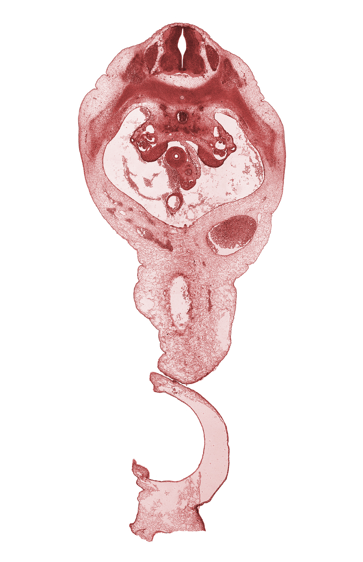 T-11 spinal ganglion, duodenum, edge of umbilical coelom, involuting right umbilical vein, postcardinal vein, rib 12, superior mesenteric artery, superior mesenteric vein, sympathetic trunk, umbilical cord, umbilical vein