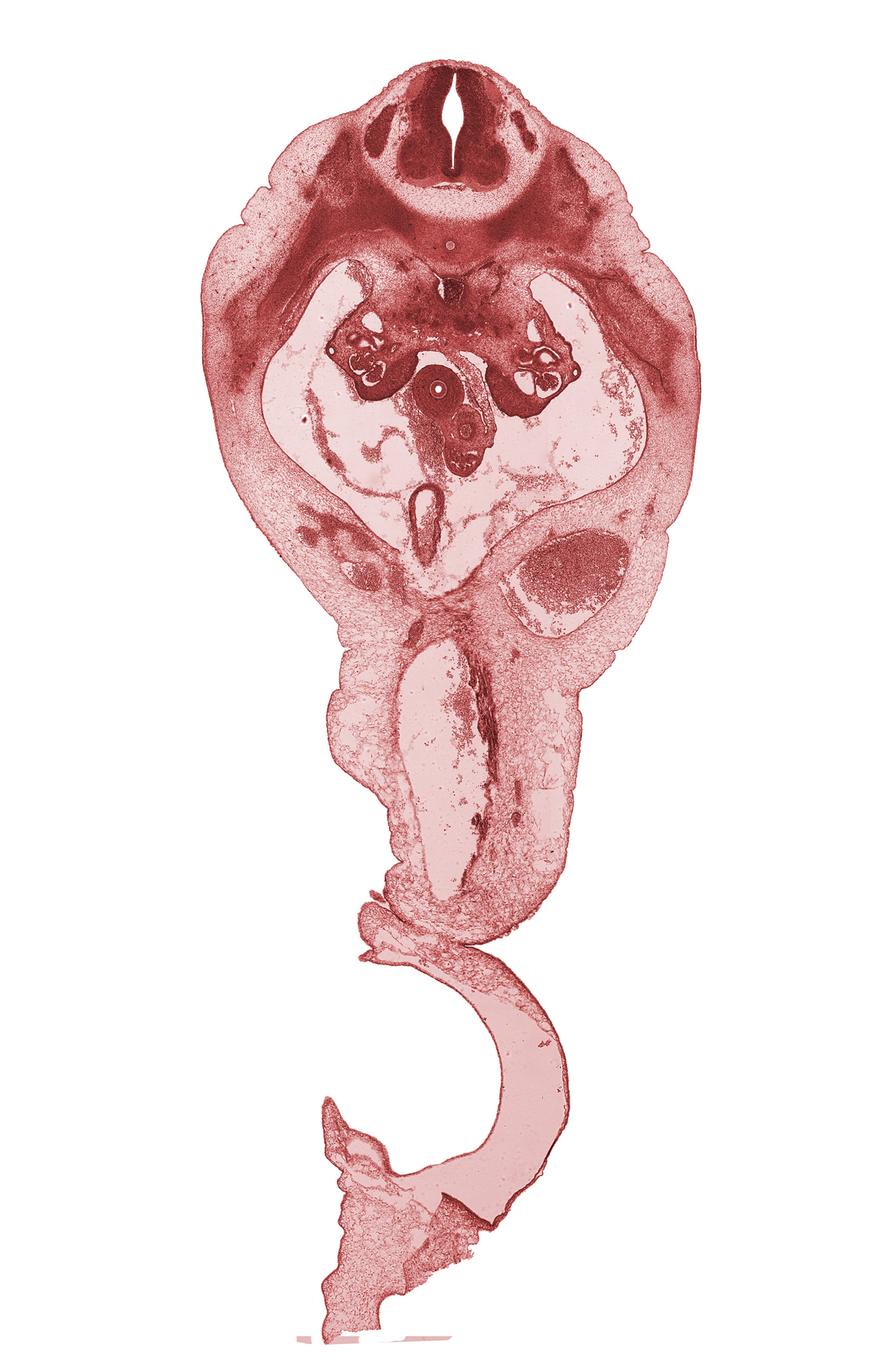 T-11 spinal ganglion, duodenum, intermediate zone, marginal zone, postcardinal vein, rib 12, superior mesenteric artery, superior mesenteric vein, umbilical coelom, umbilical vein, ventricular zone