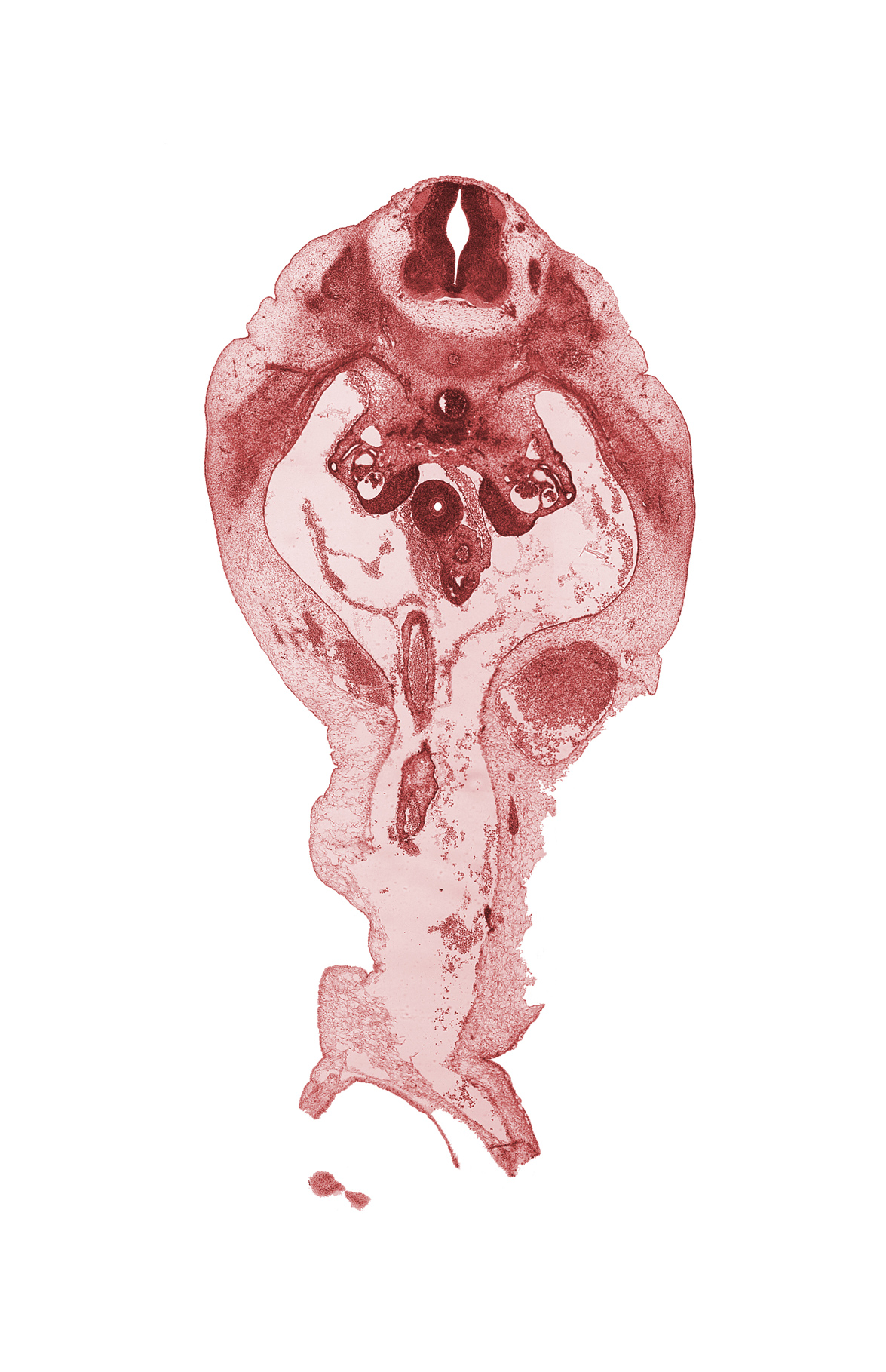 T-12 spinal ganglion, central canal of spinal cord, communicating ramus, duodenum, neural arch, peritoneal cavity, subcostal nerve (T-12), superior mesenteric artery, superior mesenteric vein, umbilical coelom, umbilical vein