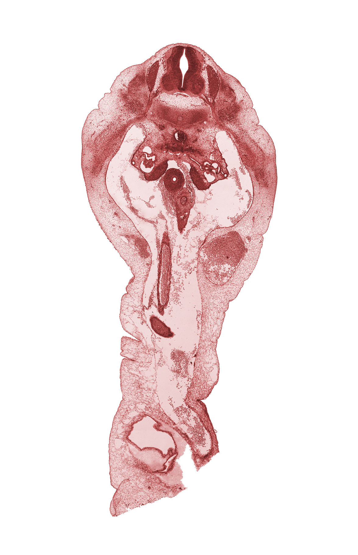 T-12 spinal ganglion, T-12 spinal nerve, blastemata of abdominal wall muscles, duodenum, edge of herniated midgut mesenchyme, epimere, gonadal ridge, mesonephric glomerulus, superior mesenteric artery, superior mesenteric vein