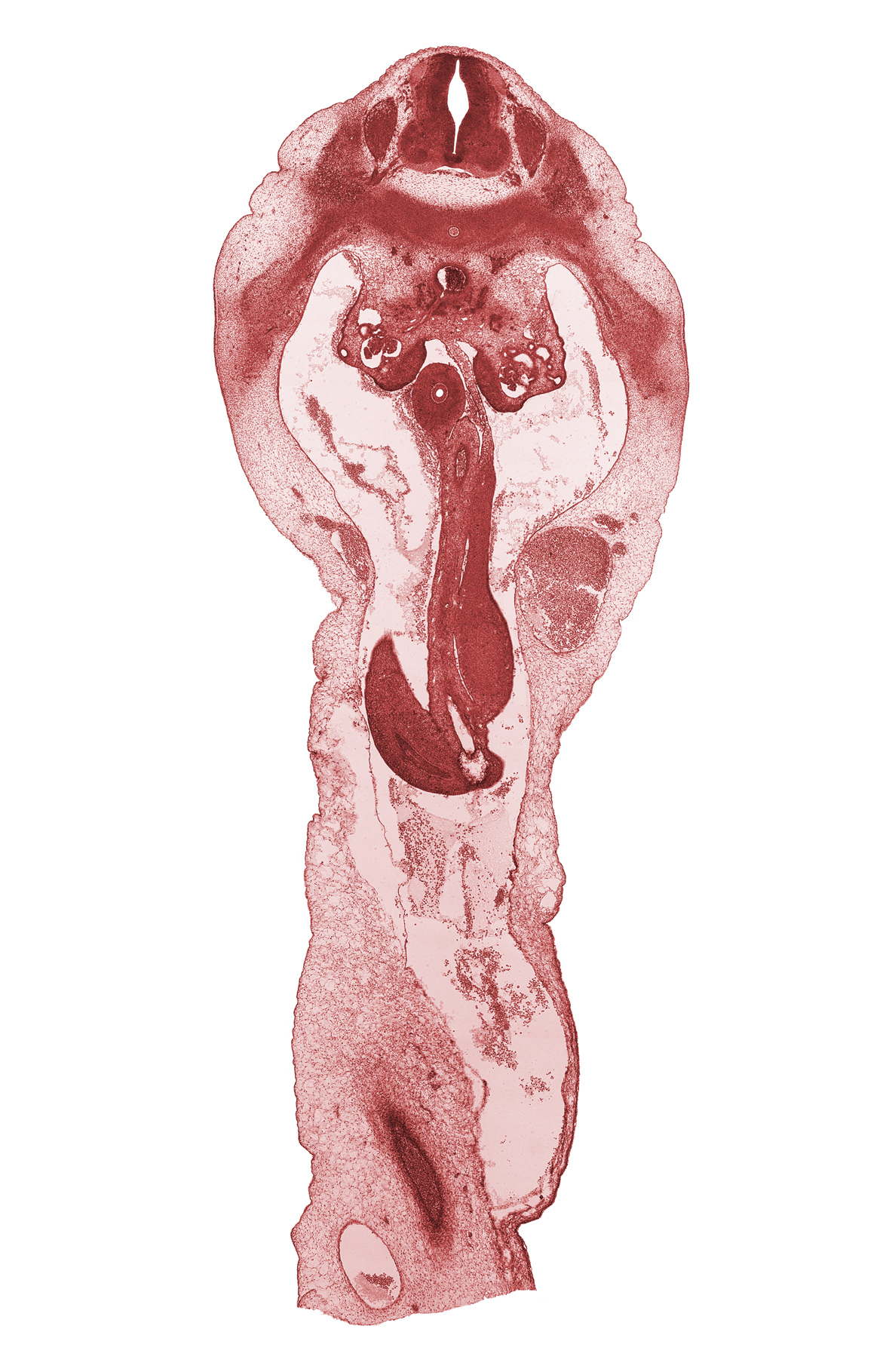 T-12 spinal ganglion, aorta, duodenum, junction of mesonephric duct and tubule, mesenchyme in mesentery of herniated midgut, postcardinal vein, subcostal nerve (T-12), superior mesenteric artery, superior mesenteric vein, sympathetic trunk