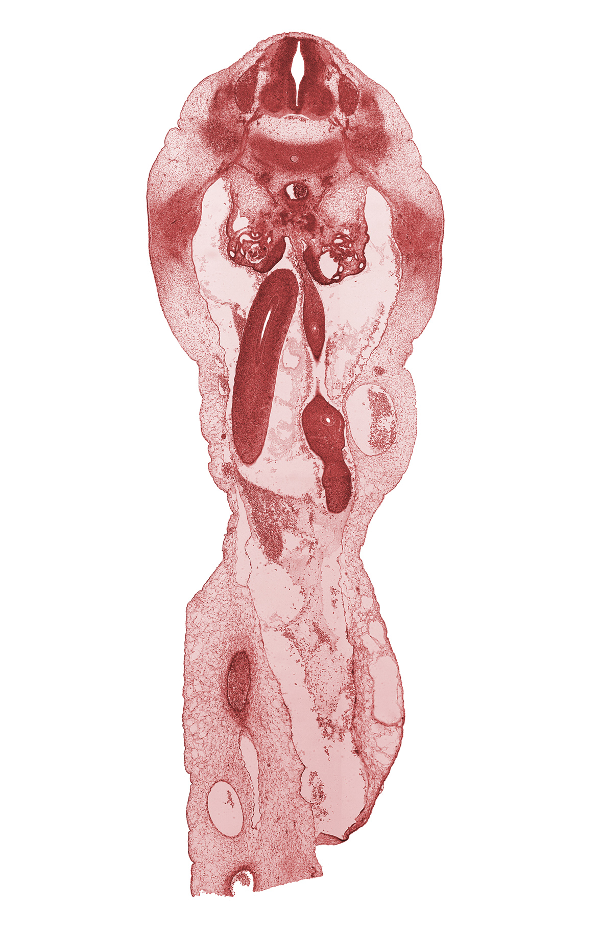 L-1 spinal ganglion, junction of hindgut and midgut, meninx, midgut condensation, nerve plexus, primordial vermiform appendix, proximal limb of herniated midgut, sympathetic trunk, umbilical vein