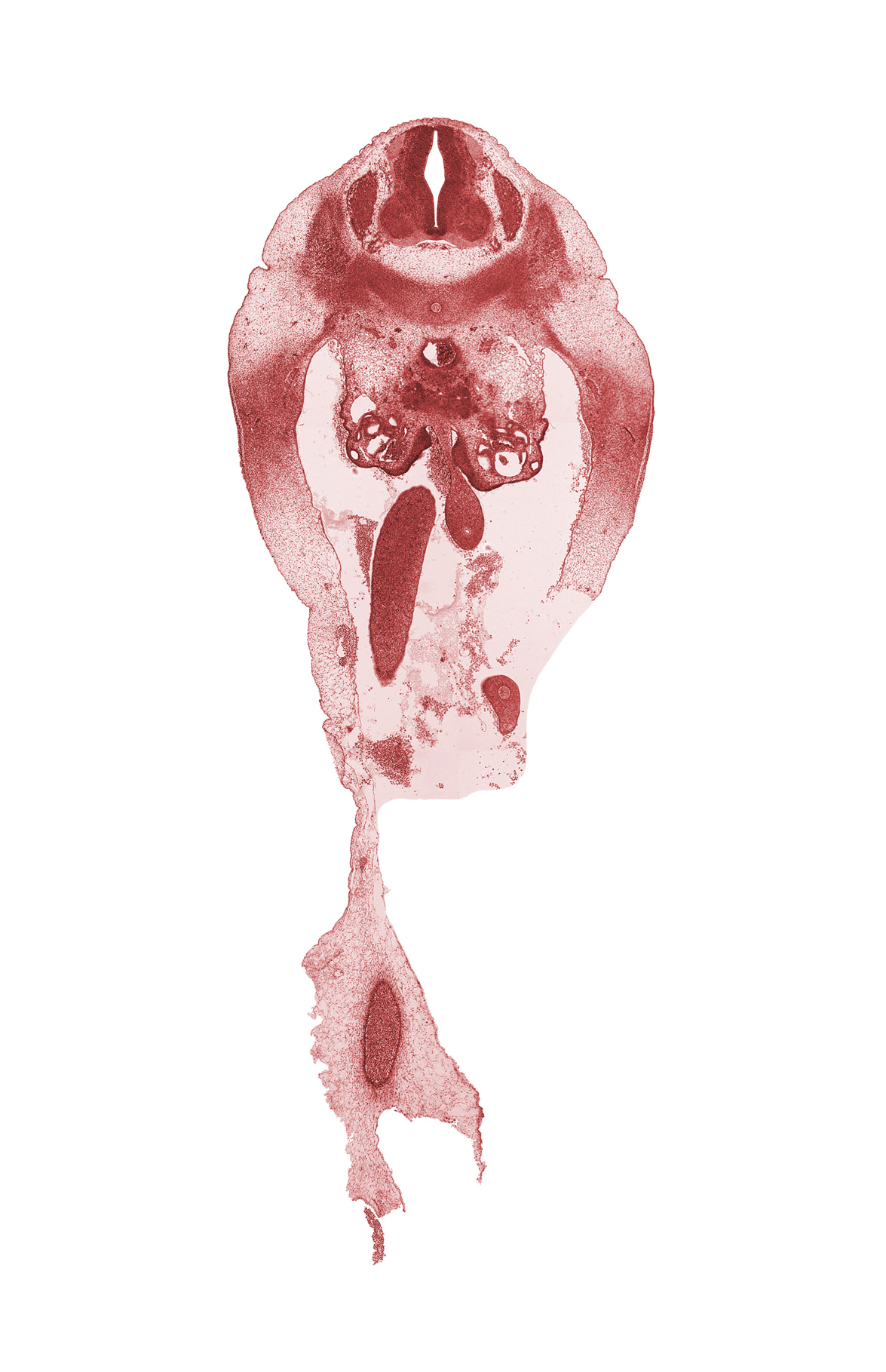 L-1 spinal ganglion, abdominal wall, aorta, hindgut endoderm, mesonephric duct, midgut condensation, missing tissue (artifact), notochord, sympathetic trunk