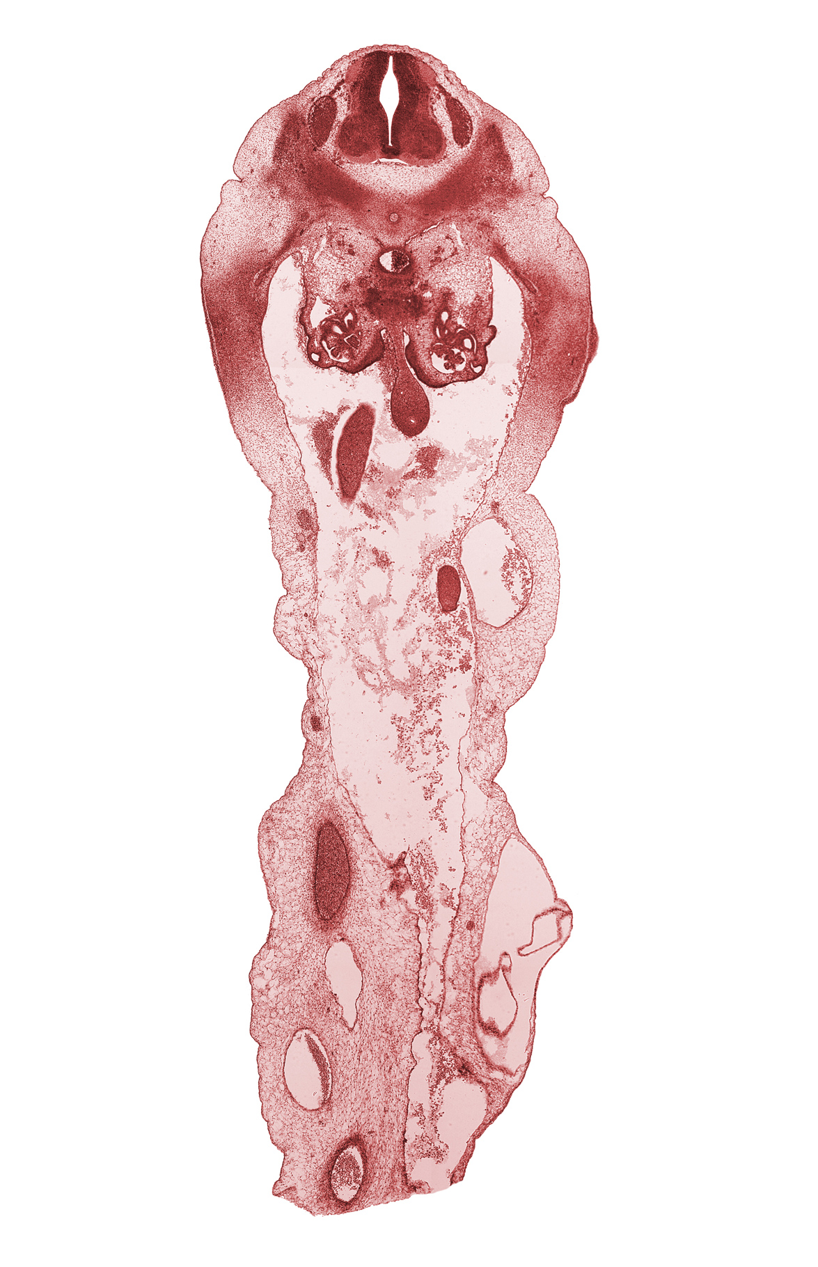 L-1 spinal ganglion, aorta, dorsal intersegmental artery, glomerulus, gonadal ridge, hindgut endoderm, hindgut mesentery, mesonephric duct, umbilical vein, wall of herniated midgut