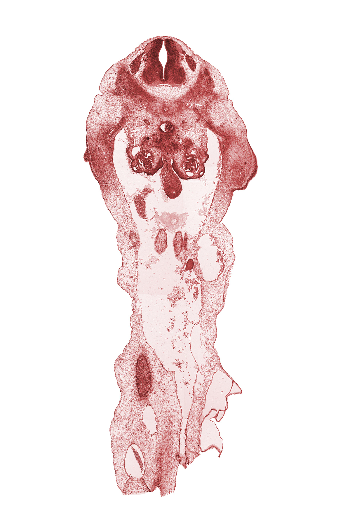 L-1 spinal ganglion, cephalic edge of metanephrogenic blastema, cephalic edge of umbilical arteries, dorsal mesentery, edge of herniated midgut, gonadal ridge, hindgut endoderm, peritoneal cavity, sympathetic trunk, umbilical coelom, umbilical vein