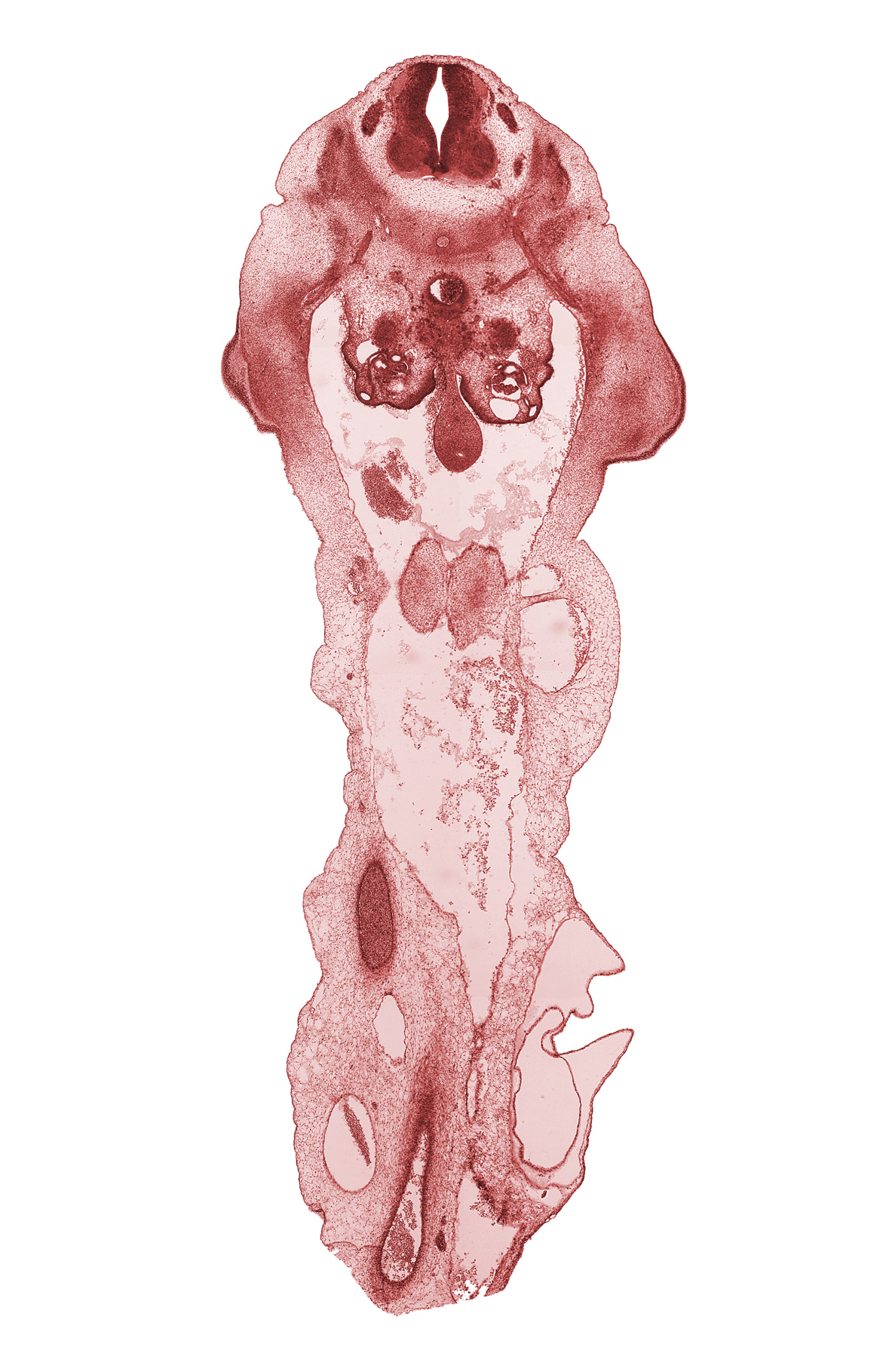 L-1 / L-2 interganglion region, L-1 spinal ganglion, L-2 spinal ganglion, L-2 spinal nerve, aorta, communicating ramus, mesonephric duct, metanephrogenic blastema, mucoid connective tissue, peritoneal cavity, postcardinal vein, umbilical coelom, umbilical vein, wall of umbilical artery