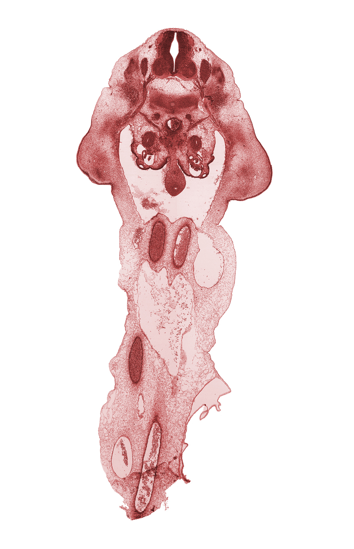 L-2 spinal ganglion, L-2 spinal nerve, dorsal mesentery, glomerulus, gonadal ridge, hindgut endoderm, left umbilical artery, mesonephric duct, pelvis of kidney (metanephros), peritoneal cavity, right umbilical artery, sympathetic trunk, umbilical coelom, umbilical vein