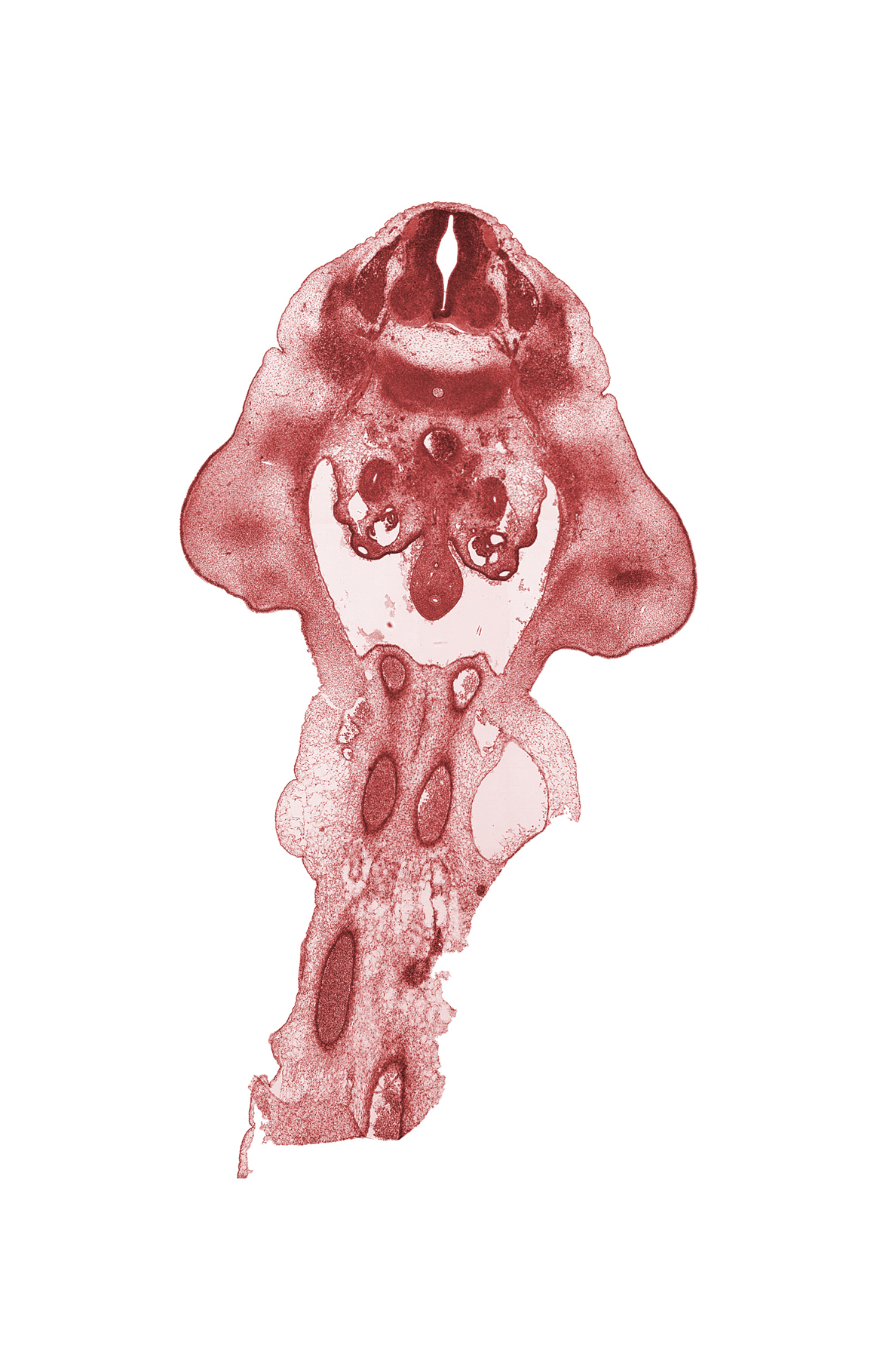 L-2 spinal ganglion, aorta, edge of allantois, hindgut, inferior mesenteric artery, left umbilical artery, metanephrogenic blastema, missing tissue (artifact), pelvis of kidney (metanephros), peritoneal cavity, right umbilical artery, thigh