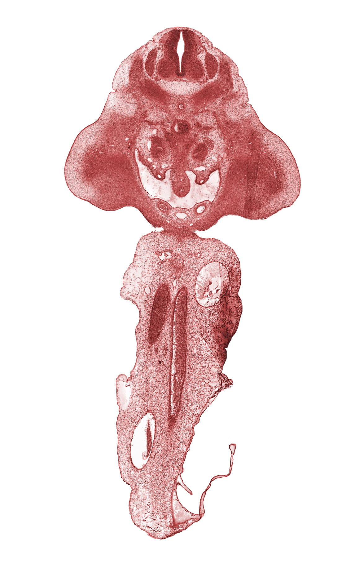 L-2 spinal ganglion, aorta, caudal edge of umbilical cord, hindgut, inferior mesenteric artery, left umbilical artery, mesonephric duct, metanephrogenic blastema, peritoneal cavity, right umbilical artery, umbilical vein