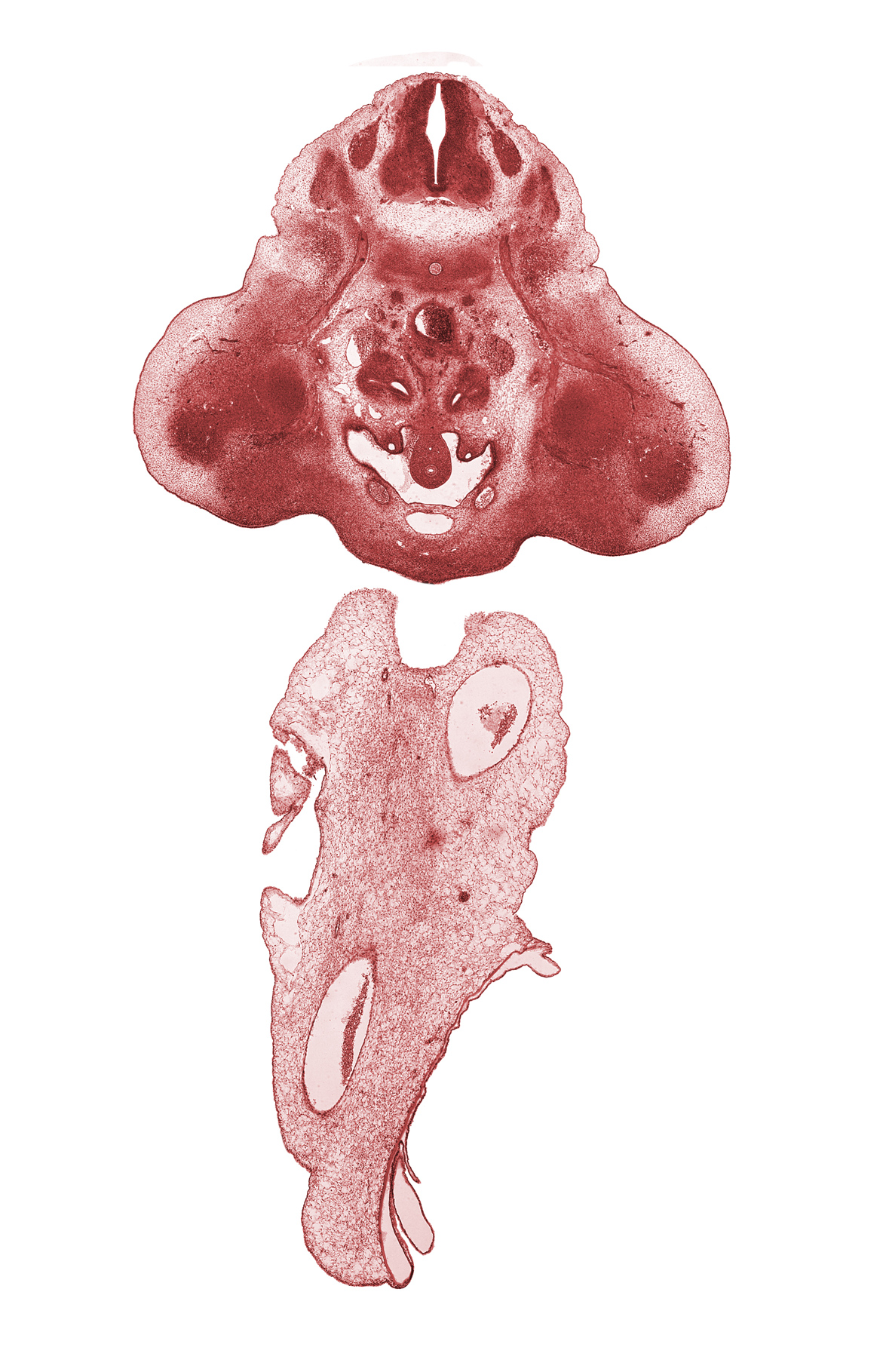 L-2 spinal ganglion, L-3 spinal nerve, hindgut, mesonephric duct, neural arch, pelvis of kidney (metanephros), peritoneal cavity, postcardinal vein, sympathetic trunk, urinary bladder (vesico-urethral canal)