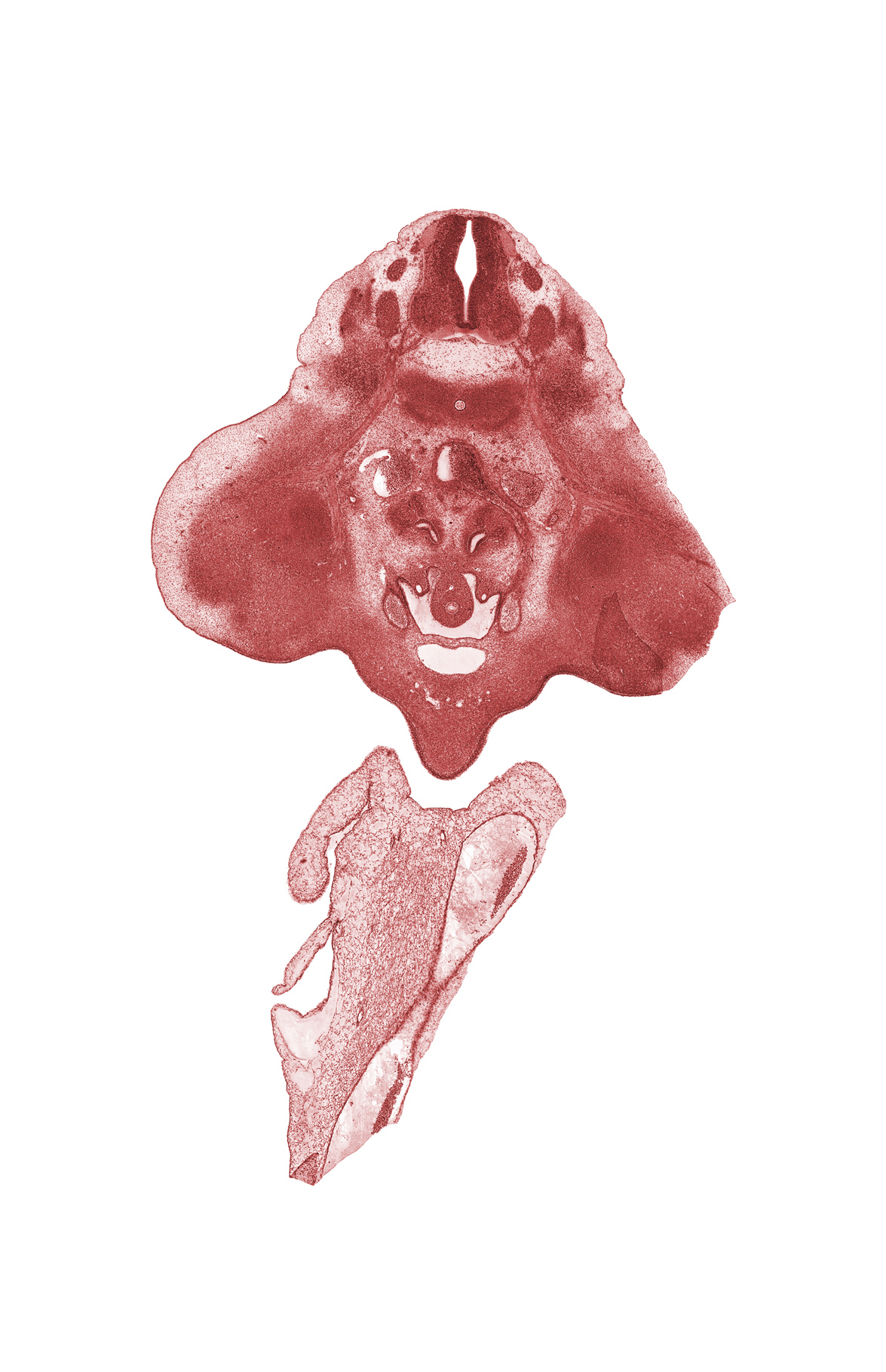 L-2 spinal ganglion, L-3 spinal ganglion, L-3 spinal nerve, aorta, genital tubercle, hindgut, inferior mesenteric artery, labioscrotal swelling, mesonephric duct, metanephrogenic blastema, pelvis of kidney (metanephros), right umbilical artery, urinary bladder (vesico-urethral canal)