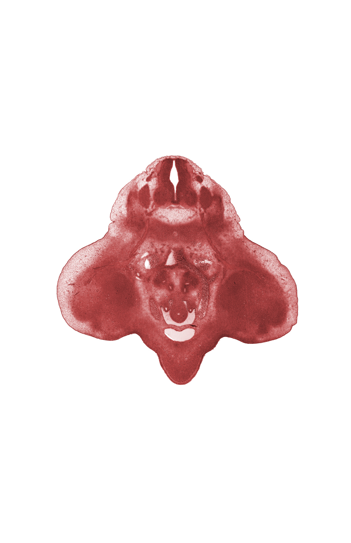 L-3 spinal ganglion, alar plate(s), aortic bifurcation, basal plate, external iliac artery, floor plate, genital tubercle, hindgut, internal iliac artery, labioscrotal swelling, left common iliac artery, mesonephric duct, metanephric duct (ureter), peritoneal cavity, roof plate, sulcus limitans, urinary bladder (vesico-urethral canal)