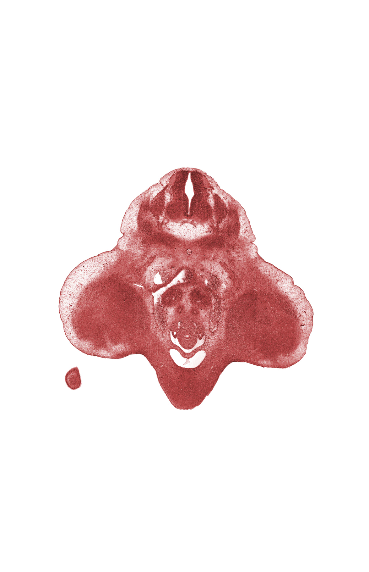 L-3 spinal ganglion, L-3 spinal nerve, edge of lower limb, embryonic pelvis of kidney (propelvis), external iliac artery, genital tubercle, internal iliac artery, left horn of urinary bladder (common excretory duct), mesonephric duct, metanephric duct (ureter), metanephrogenic blastema, postcardinal vein, right common iliac artery