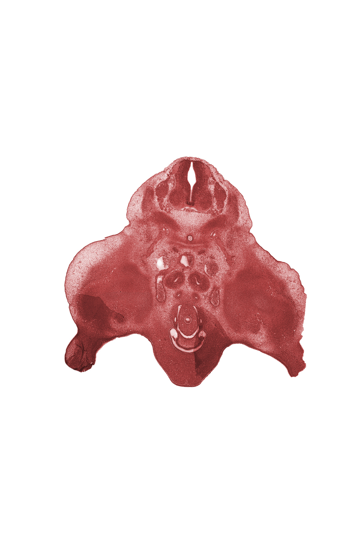 L-3 spinal ganglion, genital tubercle, horn of urinary bladder (common excretory duct), intermediate zone, internal iliac artery, junction of horn of urinary bladder and mesonephric duct, labioscrotal swelling, lower limb, marginal zone, metanephric duct (ureter), metanephrogenic blastema, skeletal blastema of pelvis, urinary bladder (vesico-urethral canal), ventricular zone