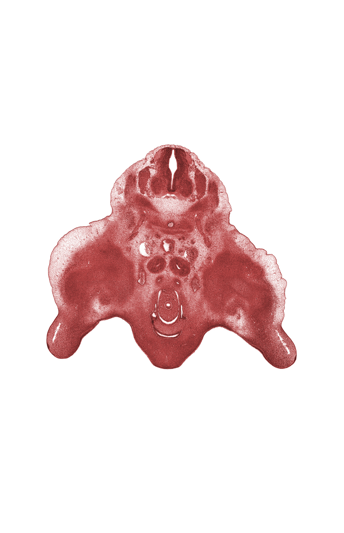 L-3 spinal ganglion, embryonic pelvis of kidney (propelvis), genital tubercle, hindgut, hindgut mesentery, junction of horn of urinary bladder and mesonephric duct, marginal vein, mesonephric duct, metanephric duct (ureter), peritoneal cavity, sympathetic trunk, urinary bladder (vesico-urethral canal)