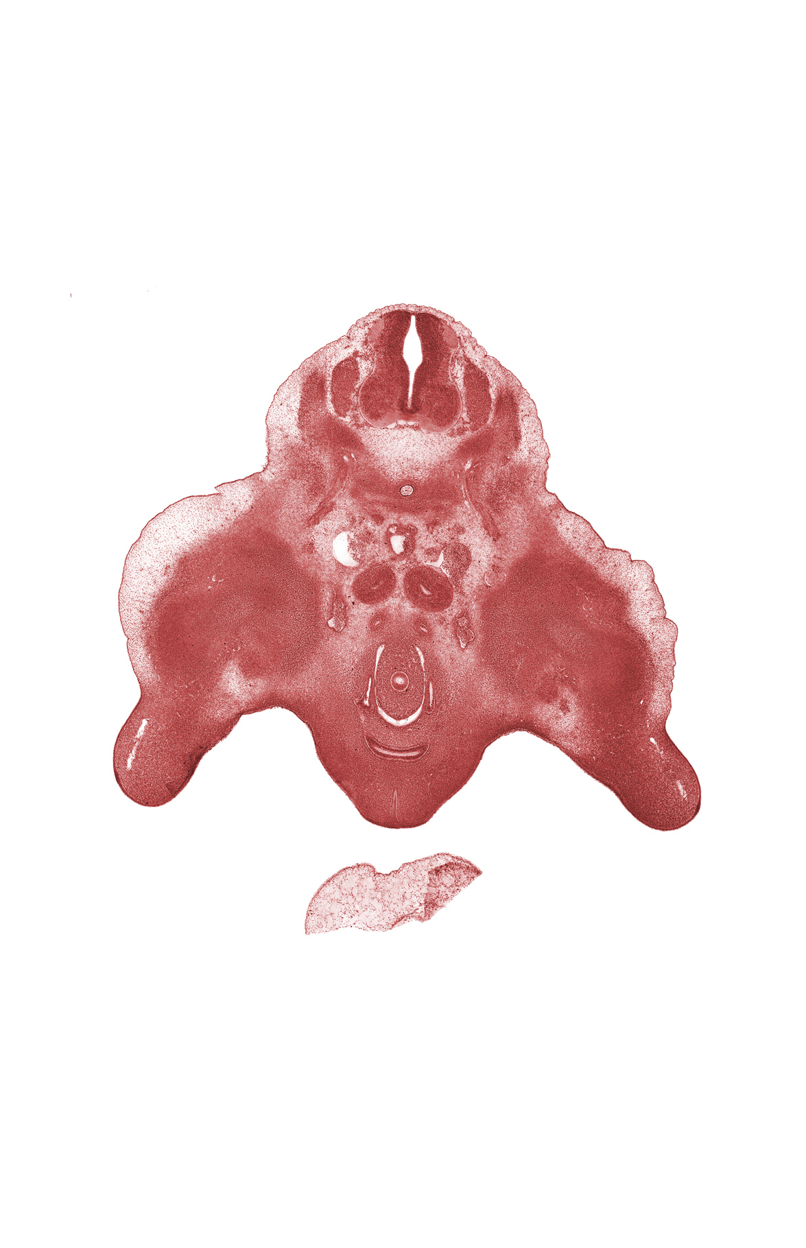 L-3 spinal ganglion, L-4 spinal nerve, dorsal mesentery, genital tubercle, hindgut (sigmoid colon), junction of mesonephric duct and metanephric duct (ureter), labioscrotal swelling, metanephric duct (ureter), skeletal blastema of femur, skeletal blastema of pelvis, urinary bladder (vesico-urethral canal)