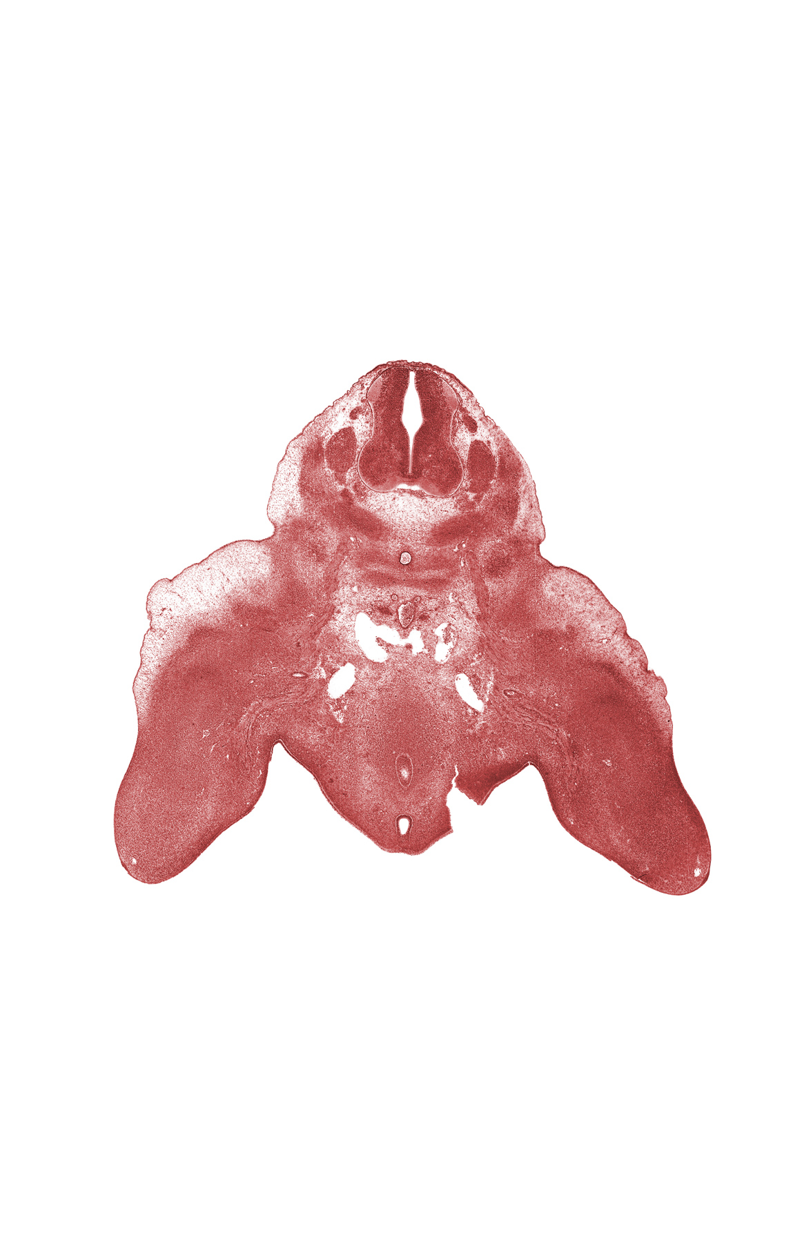 L-3 spinal ganglion, L-4 spinal ganglion, femoral artery, femoral plexus, leg region, median sacral artery, missing tissue (artifact), postcardinal vein, rectum, sympathetic trunk, urethral fold, urethral groove