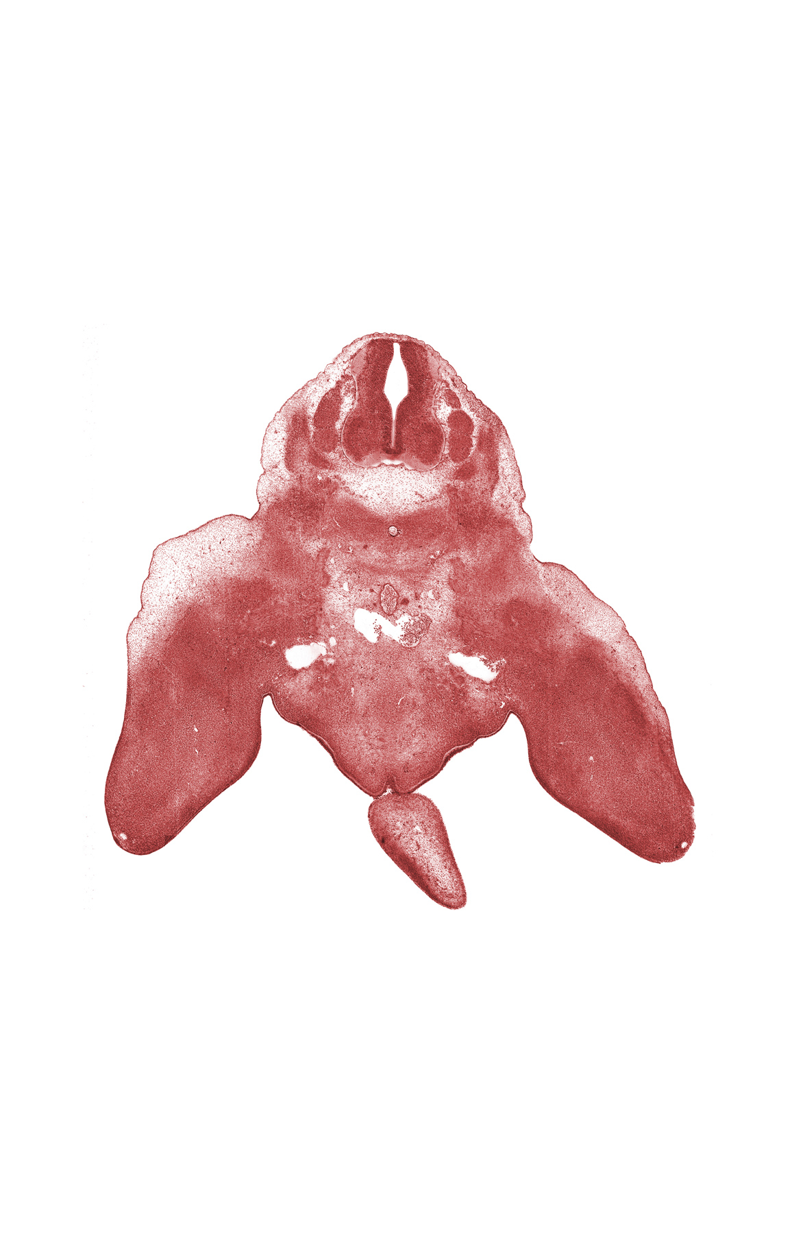 L-4 spinal ganglion, anal fold, anal pit, caudal eminence, lumbosacral plexus, median sacral artery, meninx, notochord, postcardinal vein anastomosis