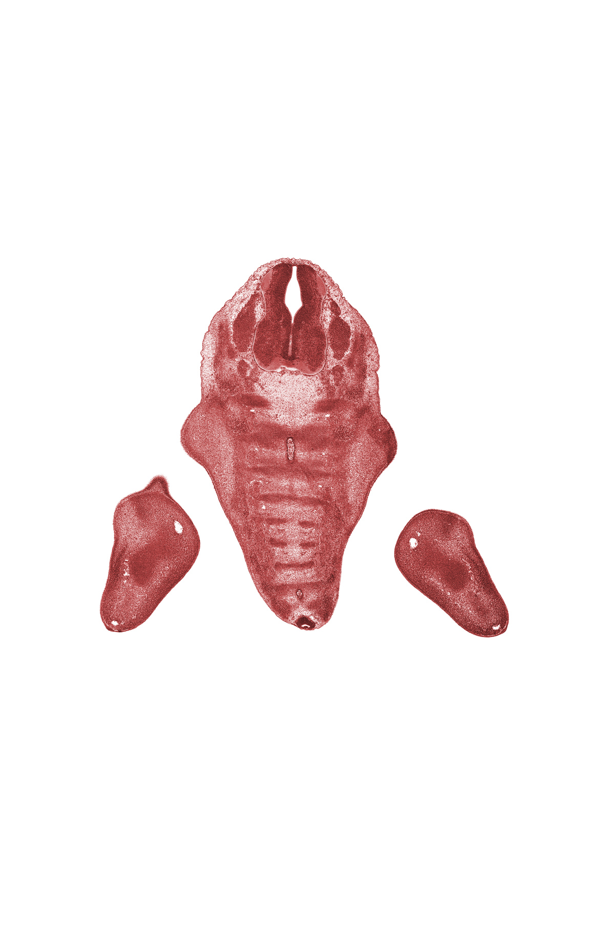 L-5 spinal ganglion, S-1 spinal ganglion, S-1 spinal nerve, S-2 spinal nerve, buttox region, coccygeal sclerotome, filum terminale, foot region, notochord