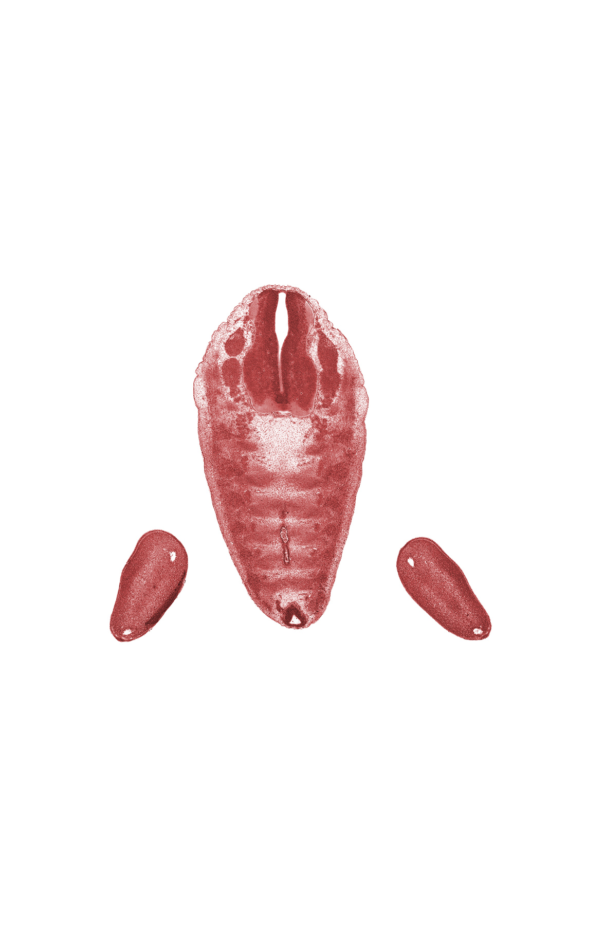 L-5 spinal ganglion, S-1 spinal ganglion, central canal, dense caudal part of sclerotome, filum terminale, foot region, loose cephalic part of sclerotome, notochord, subarachnoid space