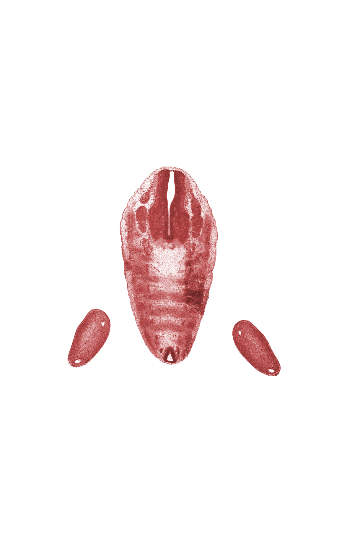 Co-1 ventral root, L-5 spinal ganglion, S-1 spinal ganglion, alar plate(s), basal plate, caudal end of spinal cord, dense caudal part of sclerotome, floor plate, foot plate, loose cephalic part of sclerotome, marginal vein, roof plate, subarachnoid space, sulcus limitans, vascular plexus