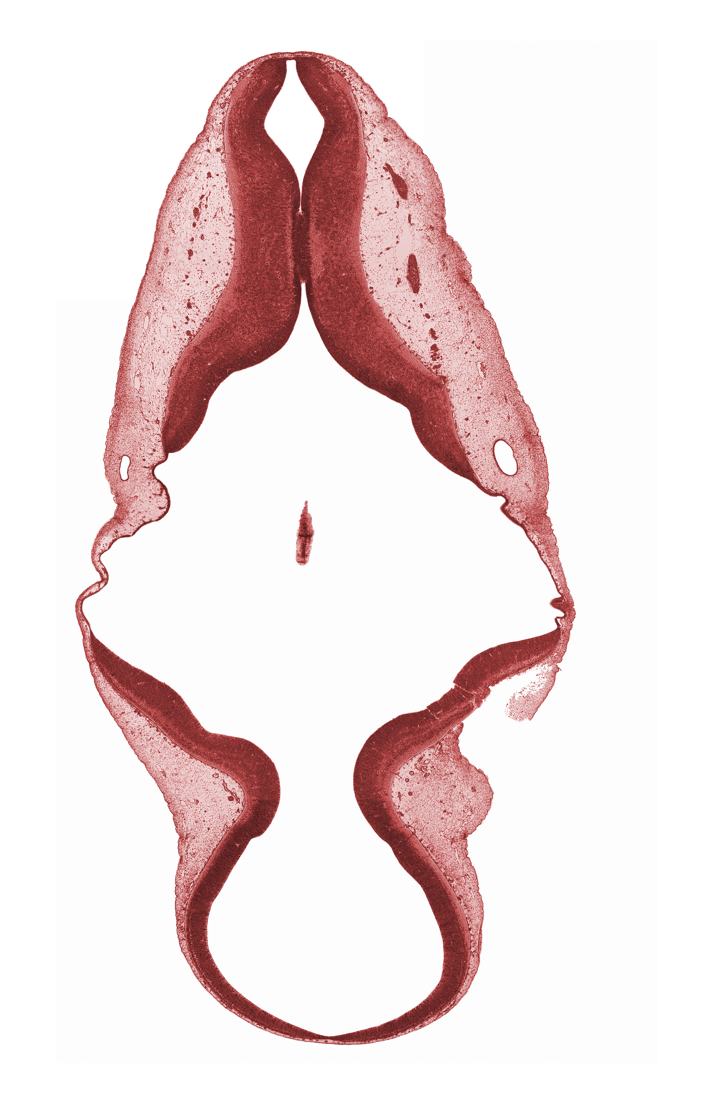 accessory nerve (CN XI), alar plate(s), artifact separation(s), basal plate, caudal edge of infolded roof plate of rhombencephalon, endolymphatic duct, junction of mesencoel and rhombencoel (fourth ventricle), mesencoel (cerebral aqueduct), myelencephalon, rhombencoel (fourth ventricle), roof plate, roof plate of myelencephalon, roof plate of rhombencephalon, root of vagus nerve (CN X), sulcus limitans, trochlear nerve (CN IV)