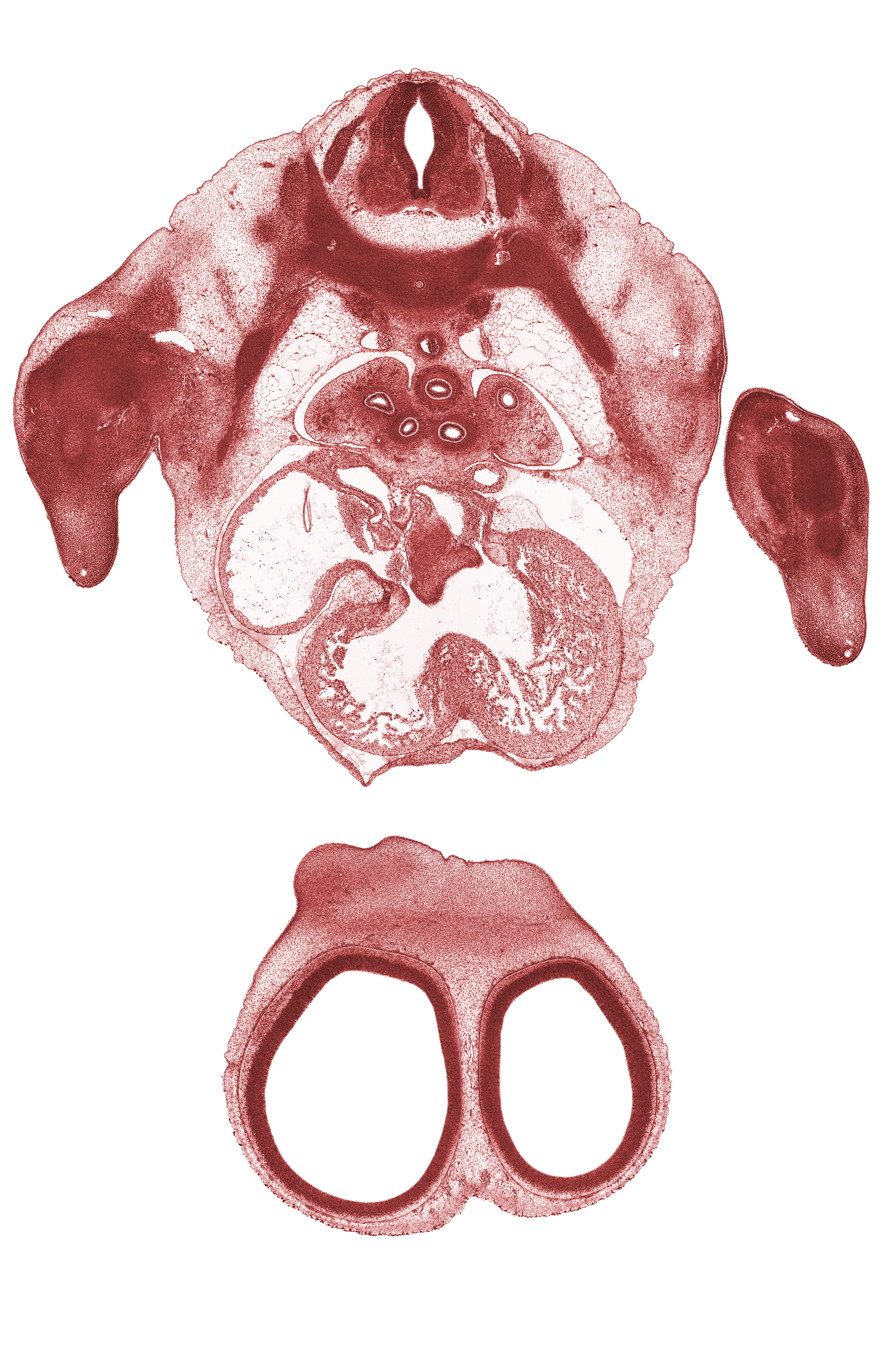 T-3 spinal ganglion, aorta, cerebral vesicle (telencephalon), dense caudal part of sclerotome, fused atrioventricular endocardial cushions, interorbital ligament, interventricular foramen, lateral ventricle, left atrioventricular canal, left atrium, left lower secondary bronchus, marginal vein, nasofrontal groove (interorbital groove), neural arch, pericardial cavity, rib 3, right atrioventricular canal, right atrium, sinus venosus