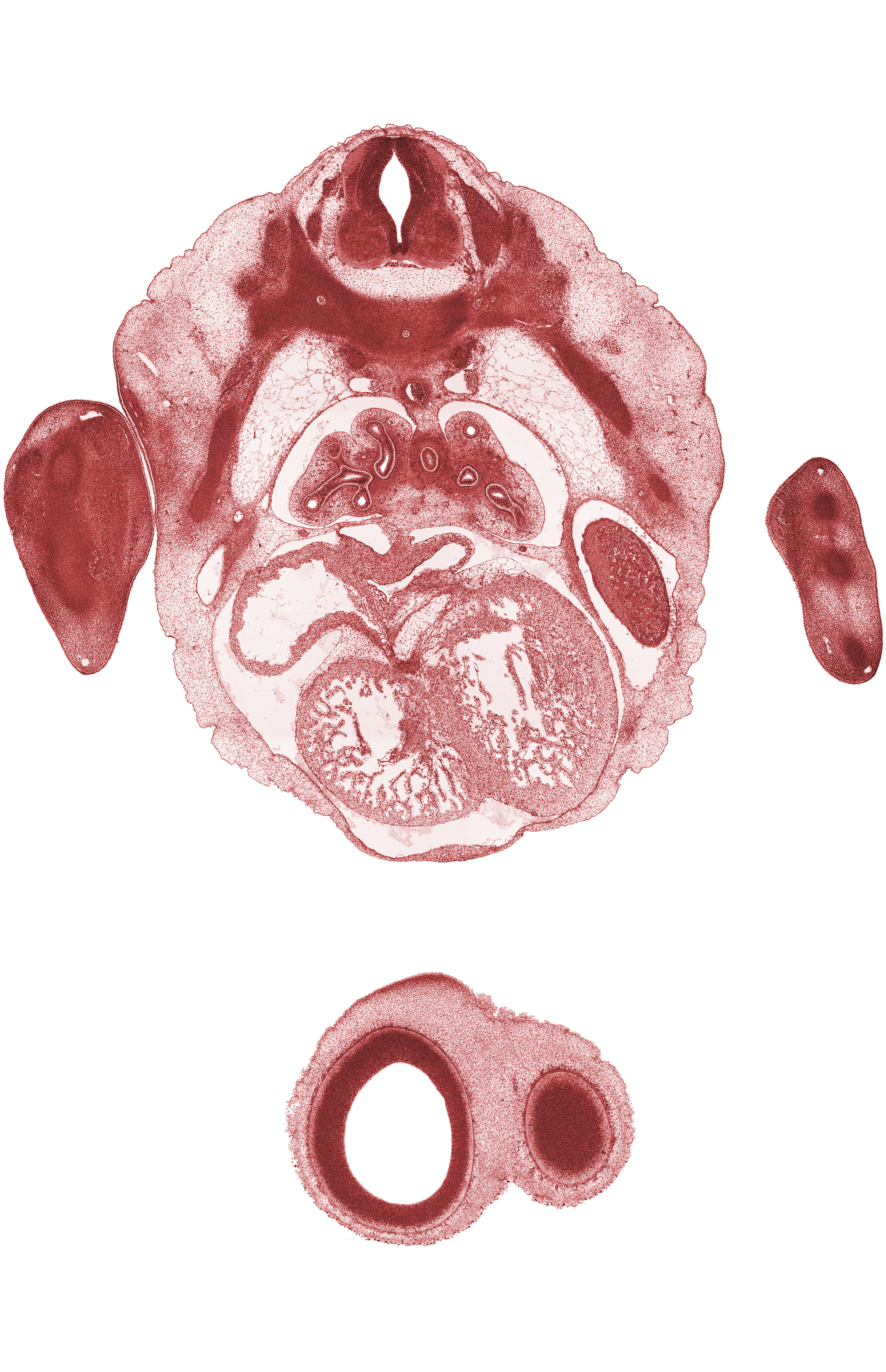 T-4 spinal ganglion, aorta, cerebral vesicle (telencephalon), edge of peritoneal cavity, esophagus, hand plate, inferior vena cava, intermediate zone, junction of left sinus horn and sinus venosus, left horn of sinus venosus, left lobe of liver, marginal zone, middle secondary bronchus, postcardinal vein, rib 4, tertiary bronchopulmonary buds in lower lobe of left lung
