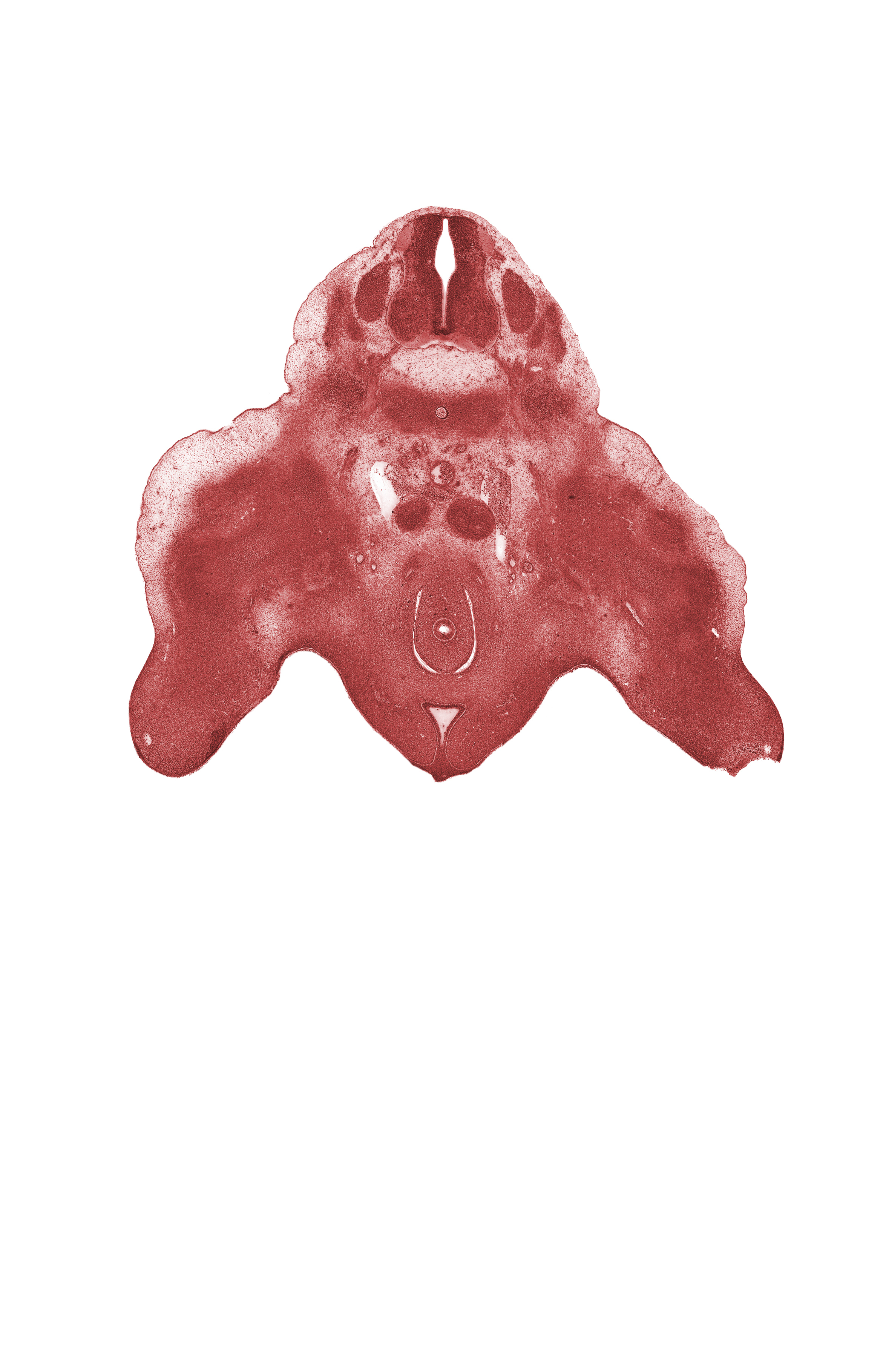 L-3 spinal ganglion, alar plate(s), basal plate, floor plate, meninx, metanephric duct (ureter), metanephrogenic blastema, missing tissue (artifact), peritoneal cavity, roof plate, sulcus limitans, urethra (phallic part of urogenital sinus), urethral fold, urethral groove
