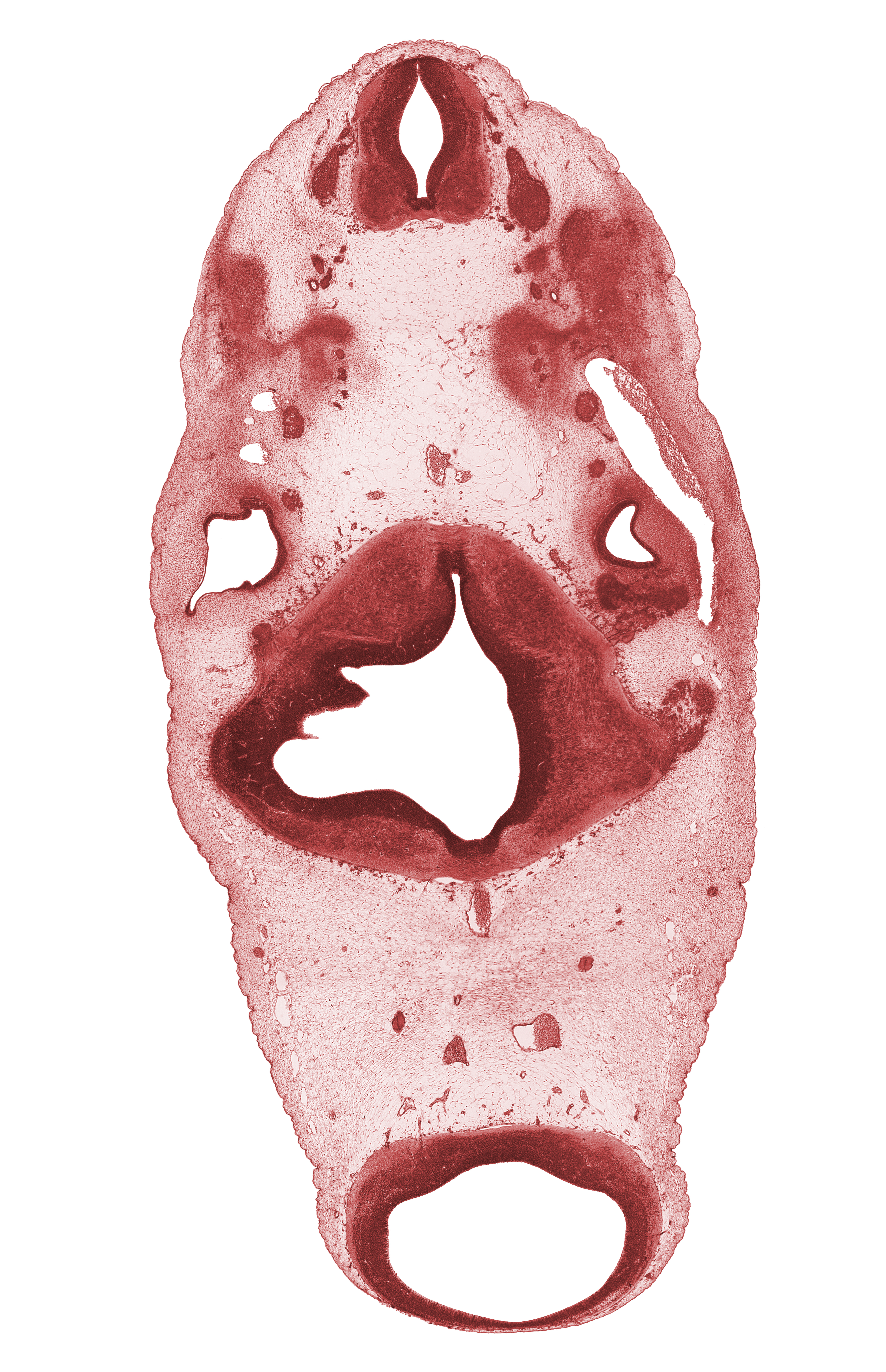 C-2 spinal ganglion, C-2 ventral root, anterior semicircular duct, basal plate cartilage, basilar artery, edge of rhombomere 3, hypoglossal nerve (CN XII), lateral semicircular duct, posterior communicating artery, spinal accessory nerve (CN XI), trigeminal ganglion (CN V), vestibulocochlear ganglion (CN VIII)