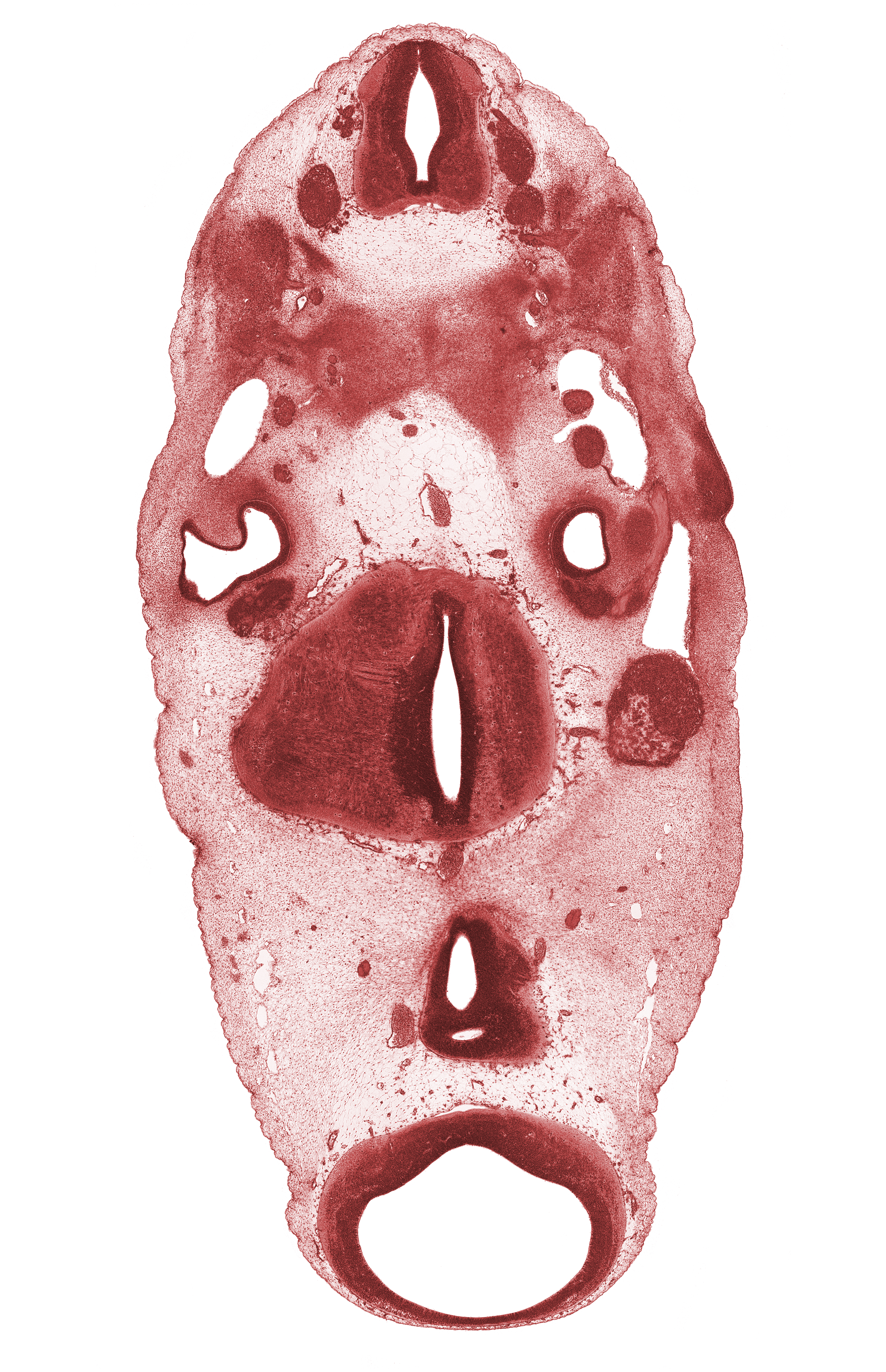 C-1 spinal nerve, C-1 vertebra (atlas) condensation, C-2 spinal ganglion, C-3 spinal ganglion, alar plate(s), anterior dural venous plexus, basal plate, basal plate cartilage, basilar artery, cerebral peduncle, edge of third ventricle, floor plate, geniculate ganglion (CN VII), glossopharyngeal nerve (CN IX), head mesenchyme, median sulcus in floor of rhombencoel (fourth ventricle), mesencoel (cerebral aqueduct), posterior communicating artery, primary head vein, roof plate, root of abducens nerve (CN VI), spinal accessory nerve (CN XI), sulcus limitans, vagus nerve (CN X)