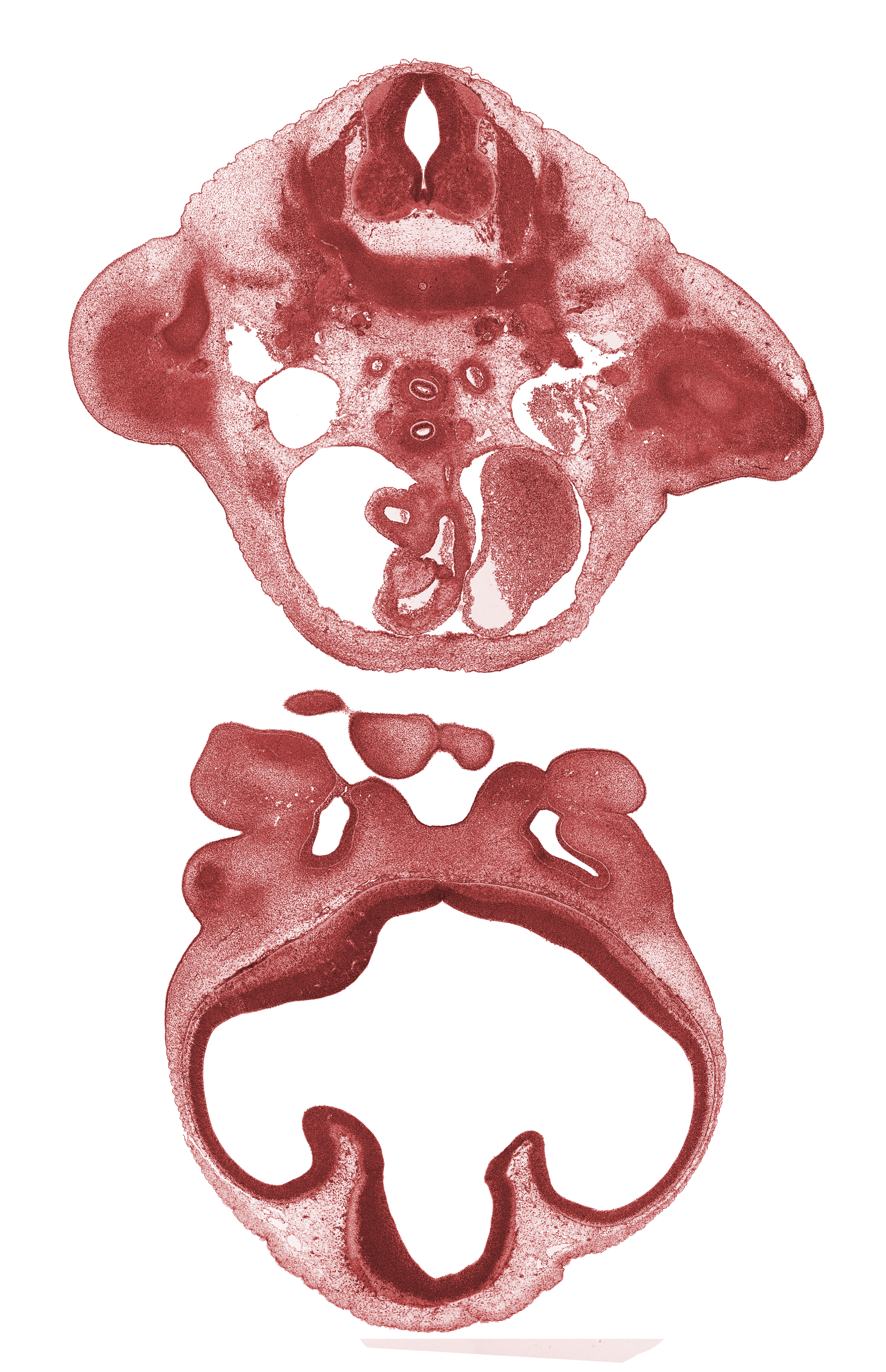 C-8 spinal ganglion, ascending aorta, axillary artery, cerebral vesicle (telencephalon), dorsal aorta, infundibulum of right ventricle, intermaxillary segment, intermediate zone, lateral ventricle, left vagus nerve (CN X), marginal zone, maxillary prominence of pharyngeal arch 1, nasal septal cartilage condensation, notochord, pericardial cavity, premuscle mass in arm, pulmonary trunk, third ventricle, torus hemisphericus, ventricular zone