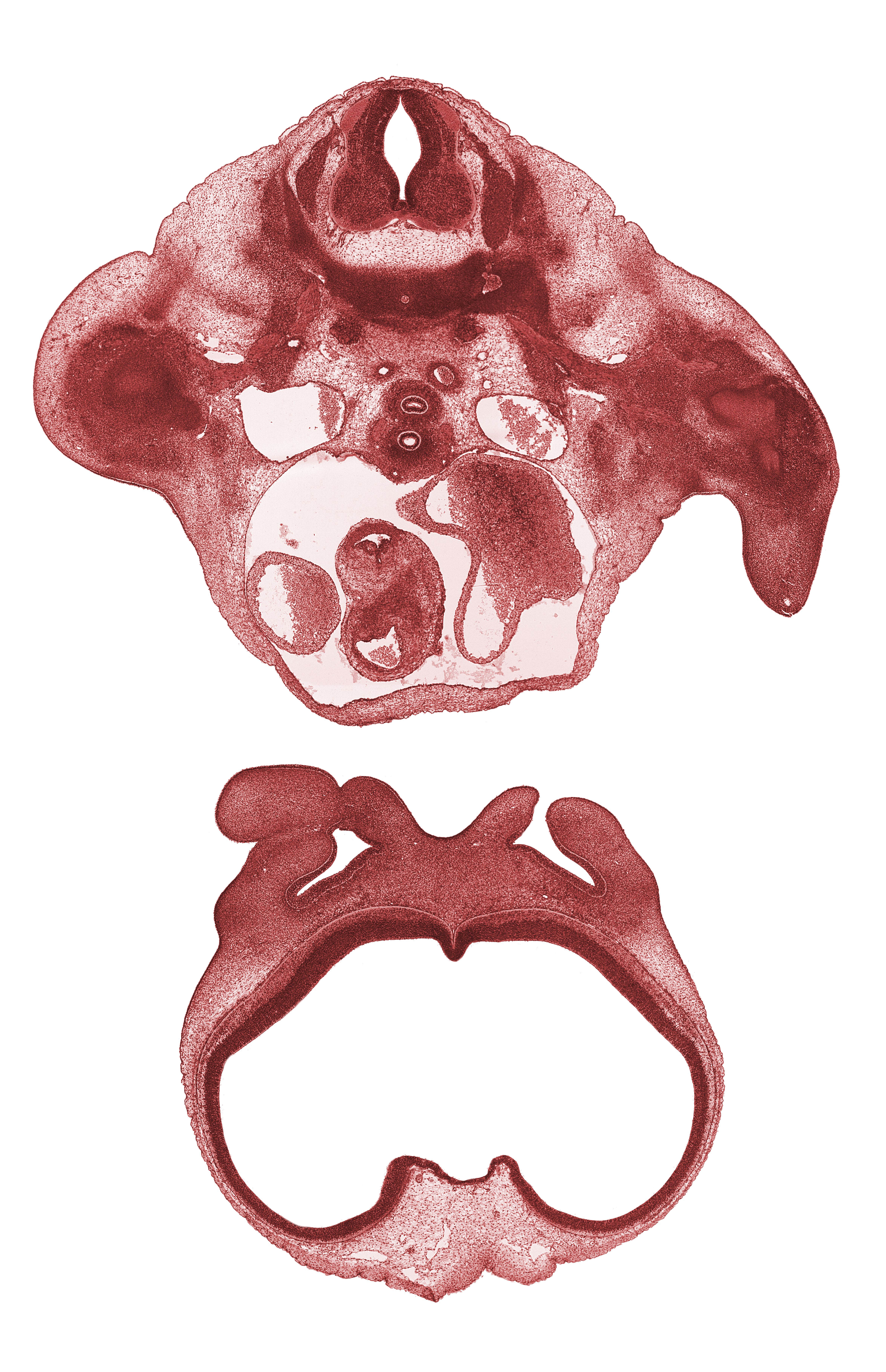 T-1 spinal ganglion, aortic semilunar valve, aorticopulmonary septum, archipallium, brachial plexus, cornu Ammonis, dorsal aorta, forearm region, gyrus dentatus, humerus cartilage, junction of maxillary and lateral nasal prominences, junction of maxillary and medial nasal prominences, lateral nasal prominence, lateral ventricle, left atrium, medial nasal prominence(s), meninx, naris, neopallium, neural arch, paleopallium, paraphysial arch, primary palate, right vagus nerve (CN X), third ventricle