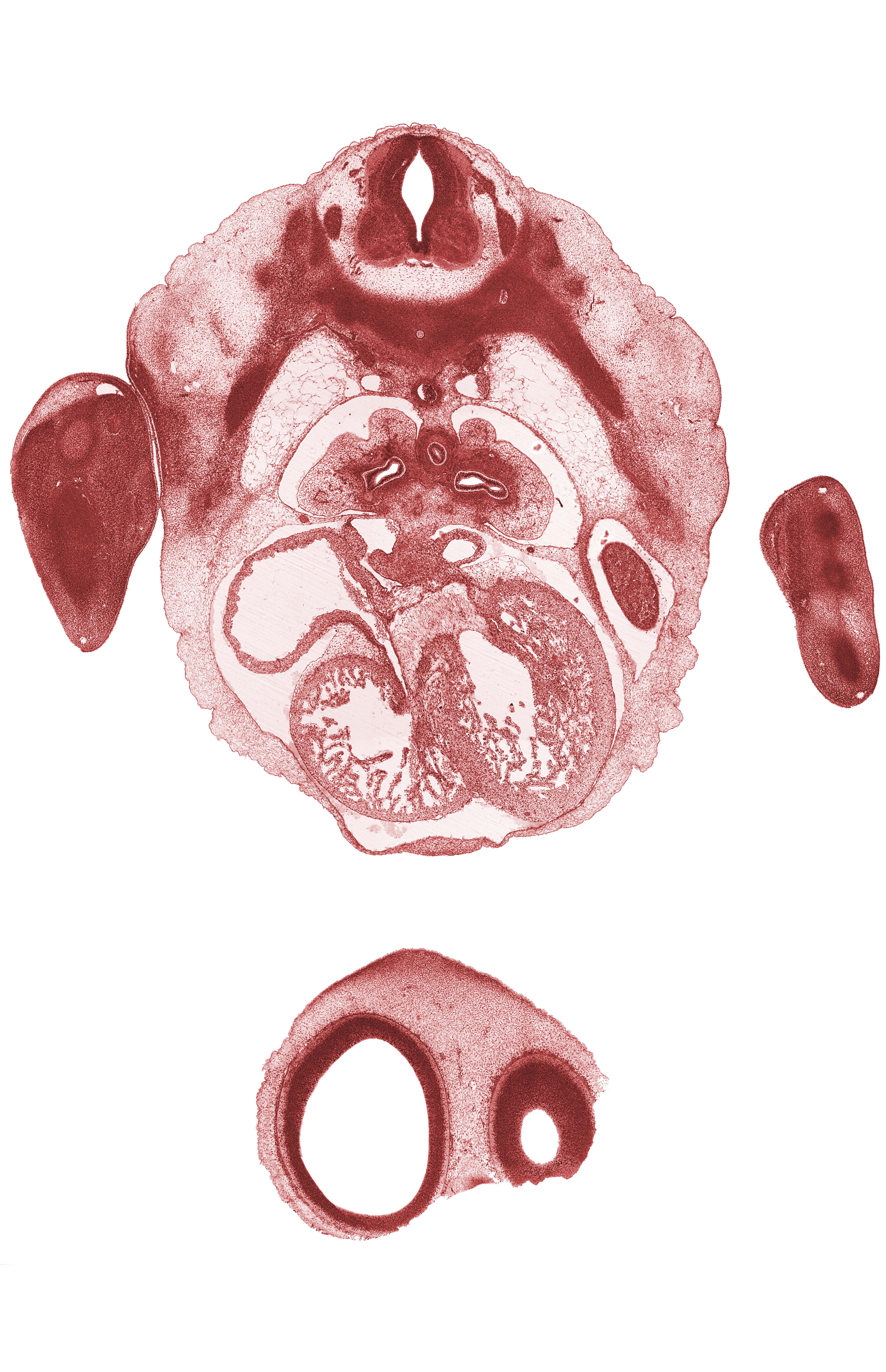 T-4 spinal ganglion, edge of left lobe of liver, frontal prominence, hand plate, left horn of sinus venosus, left ventricle, missing tissue (artifact), pleuroperitoneal membrane, rib 4, right atrioventricular canal, right atrium, right ventricle, sinus venosus