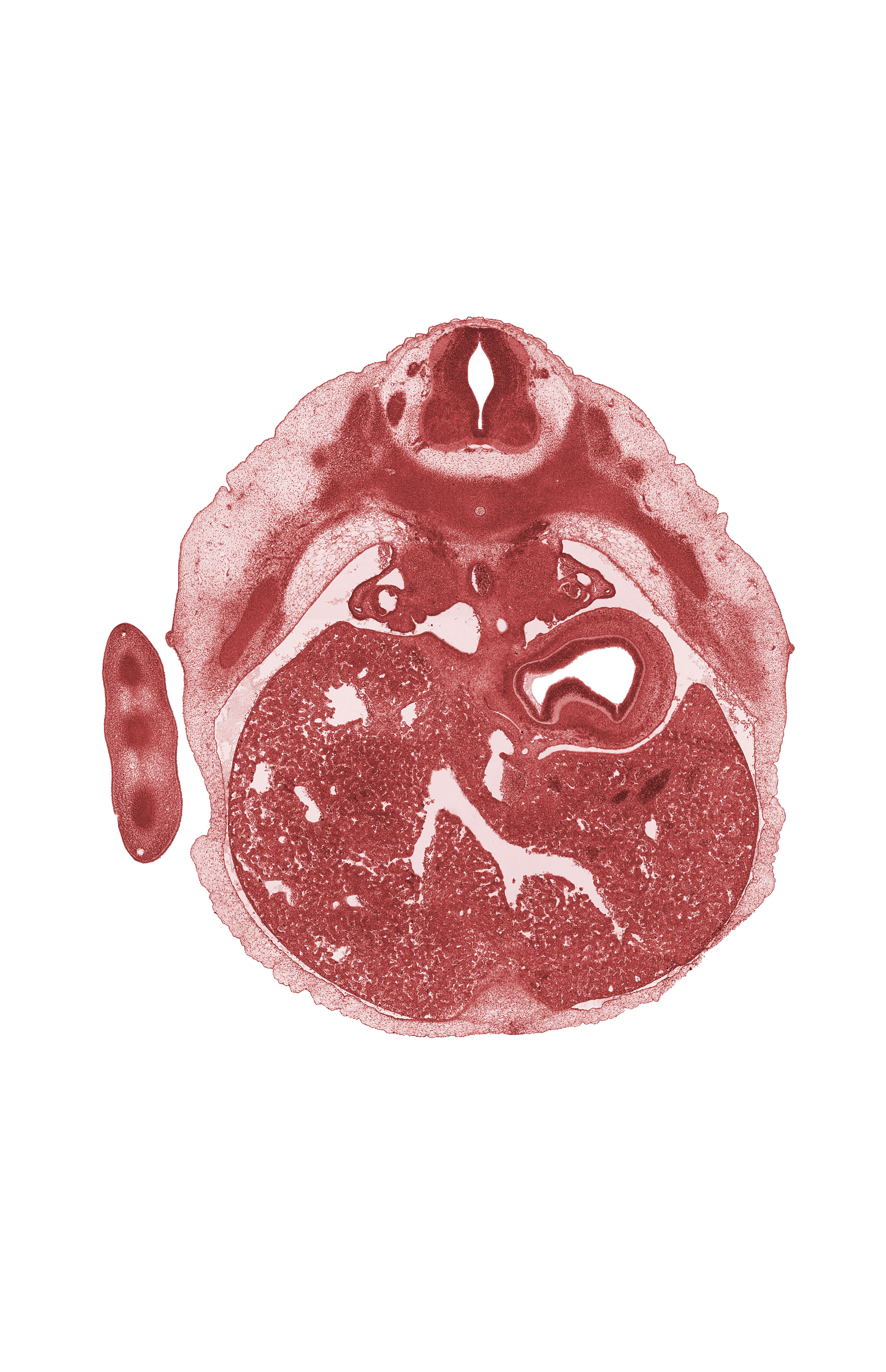 T-6 / T-7 interganglion region, ductus venosus, efferent hepatic vein, fundus of stomach, hand ray, hepatic sinusoid, junction of esophagus and stomach, neural arch, rib 7, septum transversum, suprarenal gland, sympathetic trunk