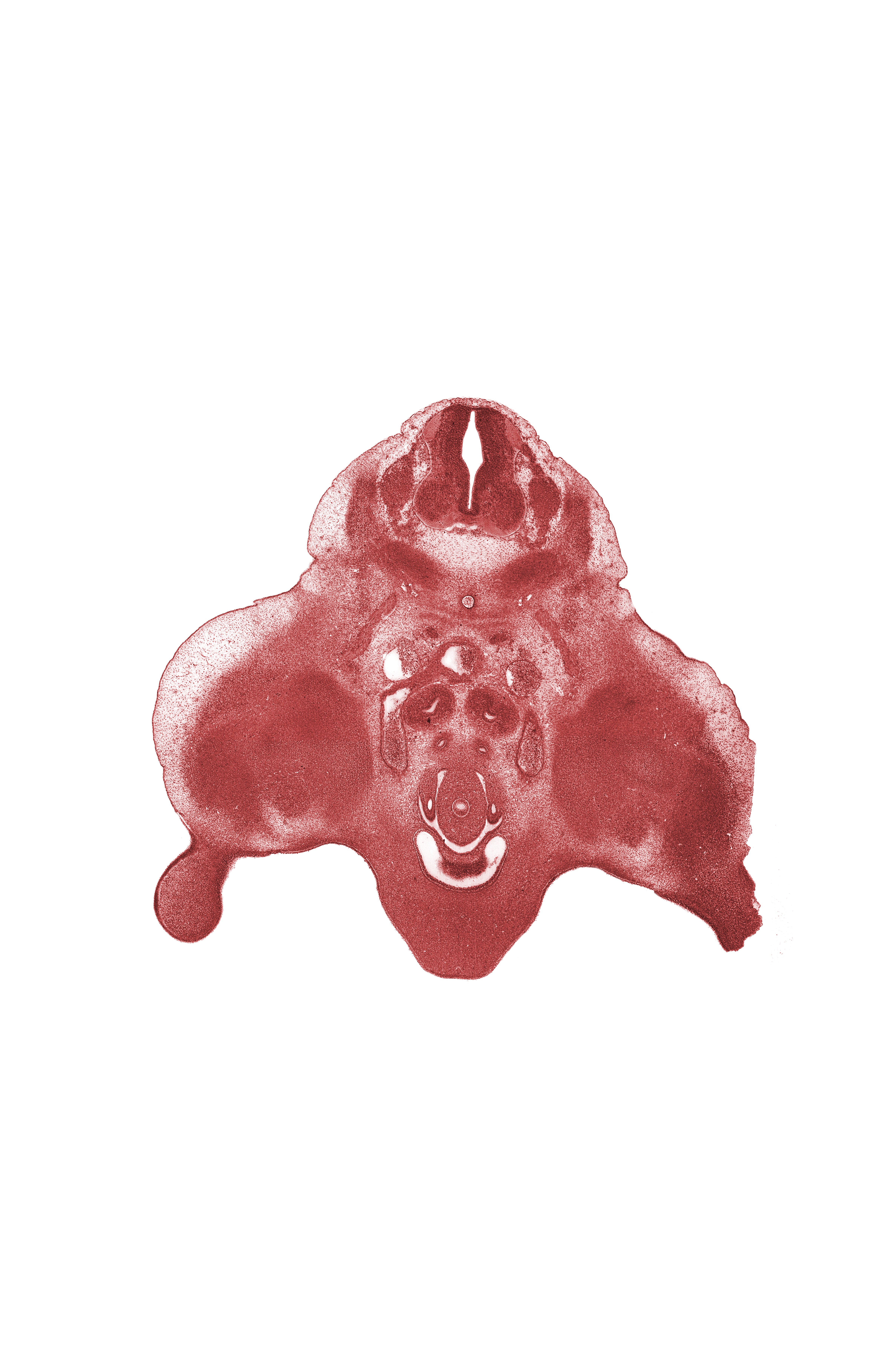 L-3 spinal ganglion, embryonic pelvis of kidney (propelvis), genital tubercle, hindgut, horn of urinary bladder (common excretory duct), internal iliac artery, labioscrotal swelling, median sacral artery, mesonephric duct, metanephric duct (ureter), peritoneal cavity, postcardinal vein