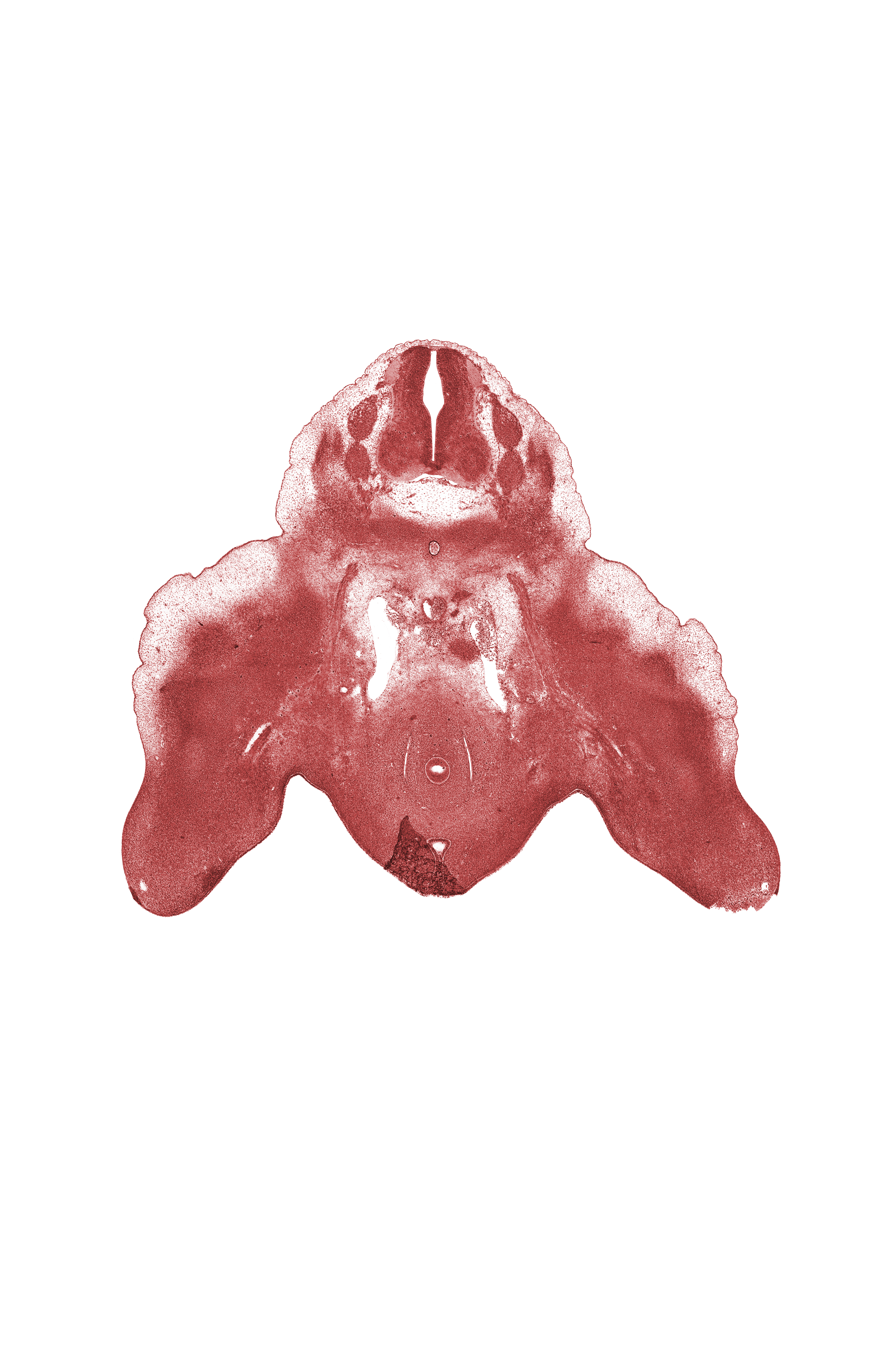 L-3 spinal ganglion, L-4 spinal ganglion, L-4 spinal nerve, caudal edge of metanephrogenic blastema, caudal edge of peritoneal cavity, epimere, missing tissue (artifact), neural arch, postcardinal vein, rectum, urethral fold, urethral groove, urorectal septum
