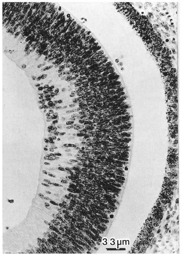 Photomicrograph of the eye