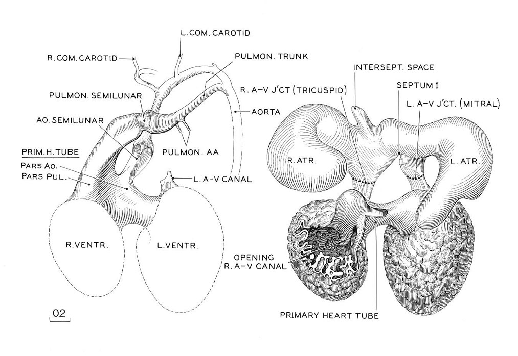 Reconstruction of the endocardium of the heart and its arterial trunks in embryo No. 6520