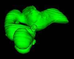 X-Axis Rotation of the Brain