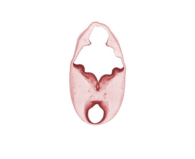 alar plate (tectum), alar plate of metencephalon (cerebellum), artifact separation(s), basal plate (tegmentum), basal plate of metencephalon, mesencephalon, oculomotor nerve (CN III), primordial choroid plexus, sulcus limitans, trochlear nerve (CN IV)