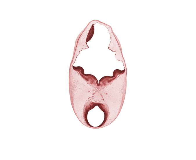 alar plate of myelencephalon, artifact separation(s), cerebral aqueduct (mesencoel), intermediate zone, marginal zone, oculomotor nerve (CN III), posterior communicating artery, primordial choroid plexus, roof plate of myelencephalon, superior cerebellar artery, ventricular zone
