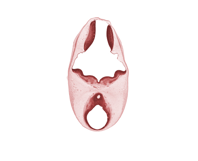 artifact separation(s), diencephalon, edge of third ventricle, oculomotor nerve (CN III), roof plate, sulcus limitans, third ventricle, trochlear nerve (CN IV)