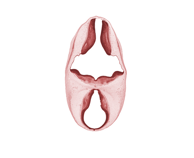 alar plate of myelencephalon, basilar artery, diencephalon, dorsal sulcus, dorsal thalamus, epithalamus, head mesenchyme, marginal ridge, median sulcus, oculomotor nerve (CN III), osteogenic layer, surface ectoderm, trochlear nerve (CN IV), ventral thalamus