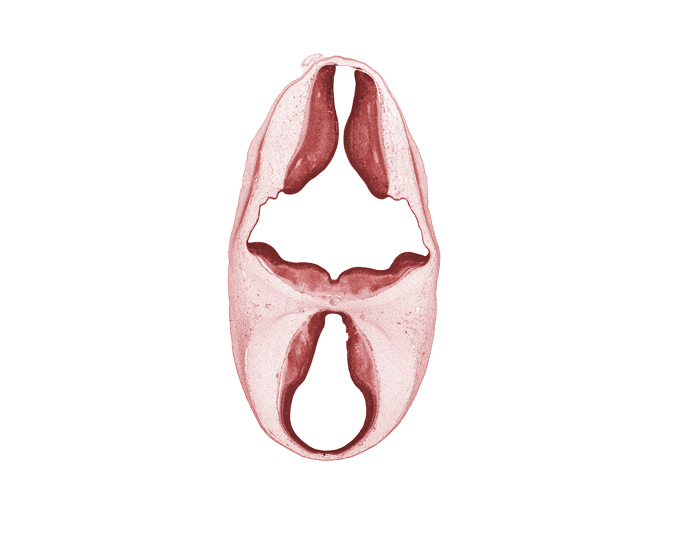 artifact separation(s), diencephalon, metencephalon, myelencephalon, rhombencoel (fourth ventricle), roof plate, subarachnoid space, third ventricle