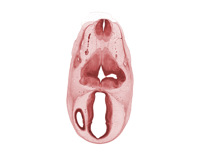 dorsal thalamus, endolymphatic sac, hypothalamus, intermediate zone, marginal ridge, marginal zone, myelencephalon, osteogenic layer, region of cervical flexure, subarachnoid space, vagus nerve (CN X), vascular plexus, ventral thalamus, ventricular zone