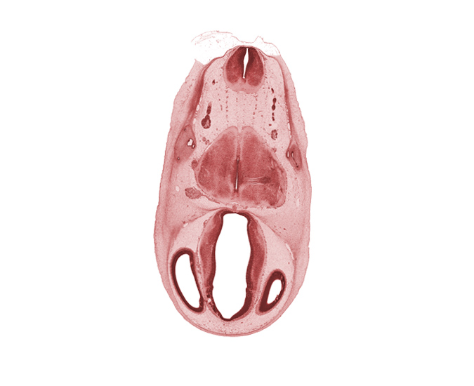 basilar artery, central canal, choroid vessel, decussation, edge of rhombencoel (fourth ventricle), head mesenchyme, lateral ventricle, osteogenic layer, posterior dural venous plexus, root of glossopharyngeal nerve (CN IX), root of hypoglossal nerve (CN XII), surface ectoderm, third ventricle, transverse fascicle