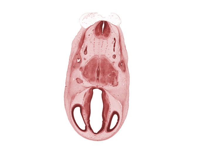 accessory nerve (CN XI), anterior semicircular duct, basal part of pons region (metencephalon), dorsal thalamus, endolymphatic duct, epithalamus, hypothalamus, intermediate zone, marginal zone, myelencephalon, pyramidal tract region, roof of diencephalon, roof plate, root of trigeminal nerve (CN V), spinal tract of trigeminal nerve (CN V), superior ganglion of vagus nerve (CN X), ventral thalamus, ventricular zone, vestibular part of otic vesicle