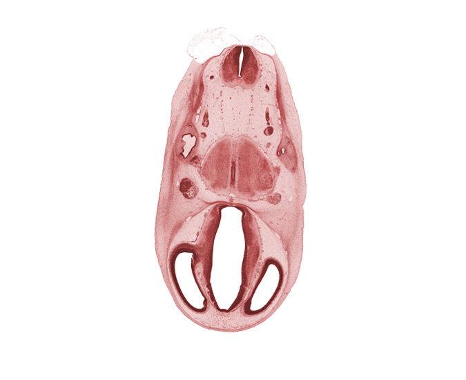 accessory nerve (CN XI), basilar artery, decussation, myelencephalon, otic capsule, pons region (metencephalon), posterior semicircular duct, pyramidal tract region, roof plate, root of facial nerve (CN VII), root of trigeminal nerve (CN V), root of vestibulocochlear nerve (CN VIII), transition region, vestibular part of otic vesicle