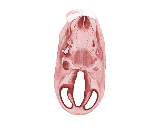 accessory nerve (CN XI), central canal, choroid vessel, diencephalon, dural band for tentorium cerebelli, endolymphatic duct, glossopharyngeal nerve (CN IX), hippocampal thickening, intermediate zone, marginal zone, osteogenic layer, root of hypoglossal nerve (CN XII), root of trigeminal nerve (CN V), spinal accessory nerve (CN XI), subarachnoid space, telencephalon, transition region, vagus nerve (CN X)